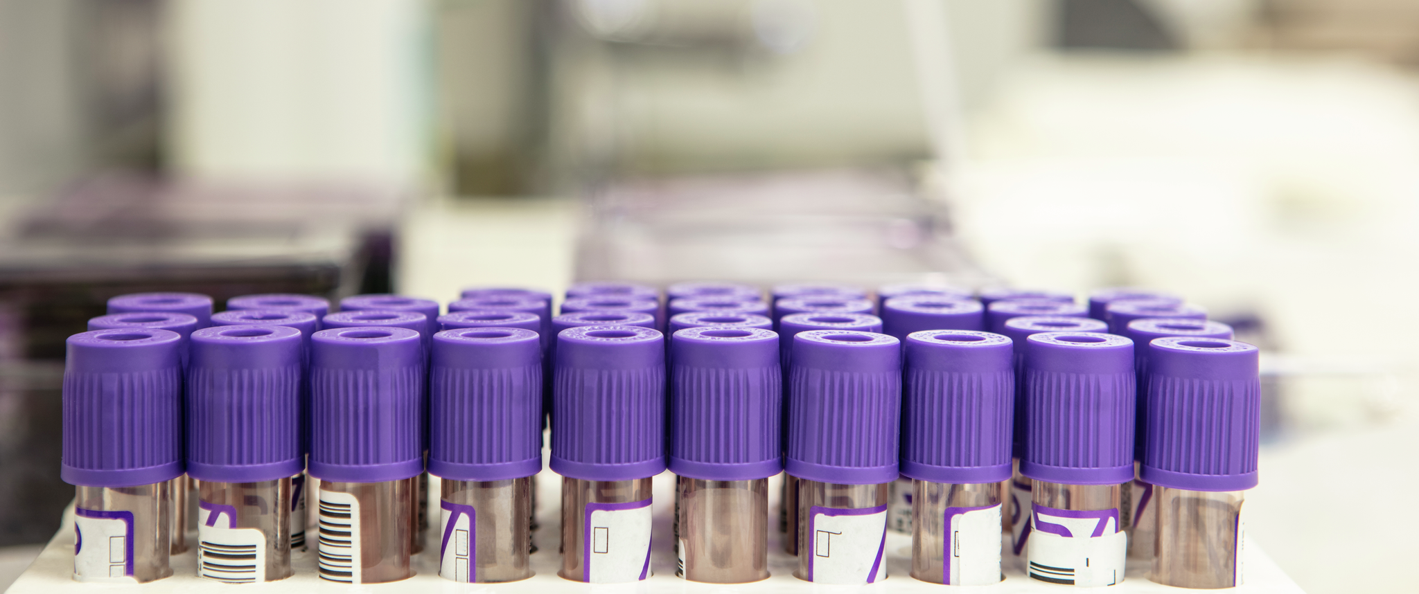 Test tubes with purple caps stand in a tray