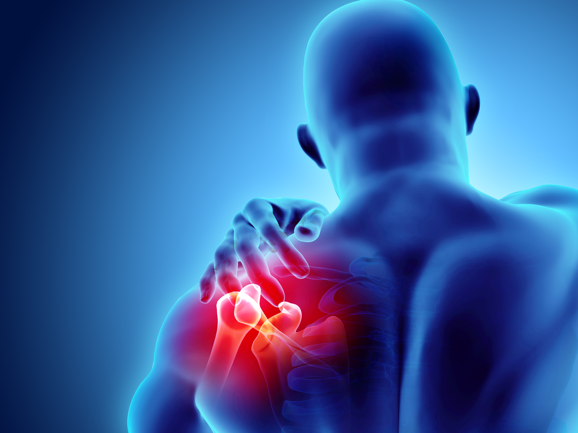 3D illustration of shoulder pain on skeleton xray