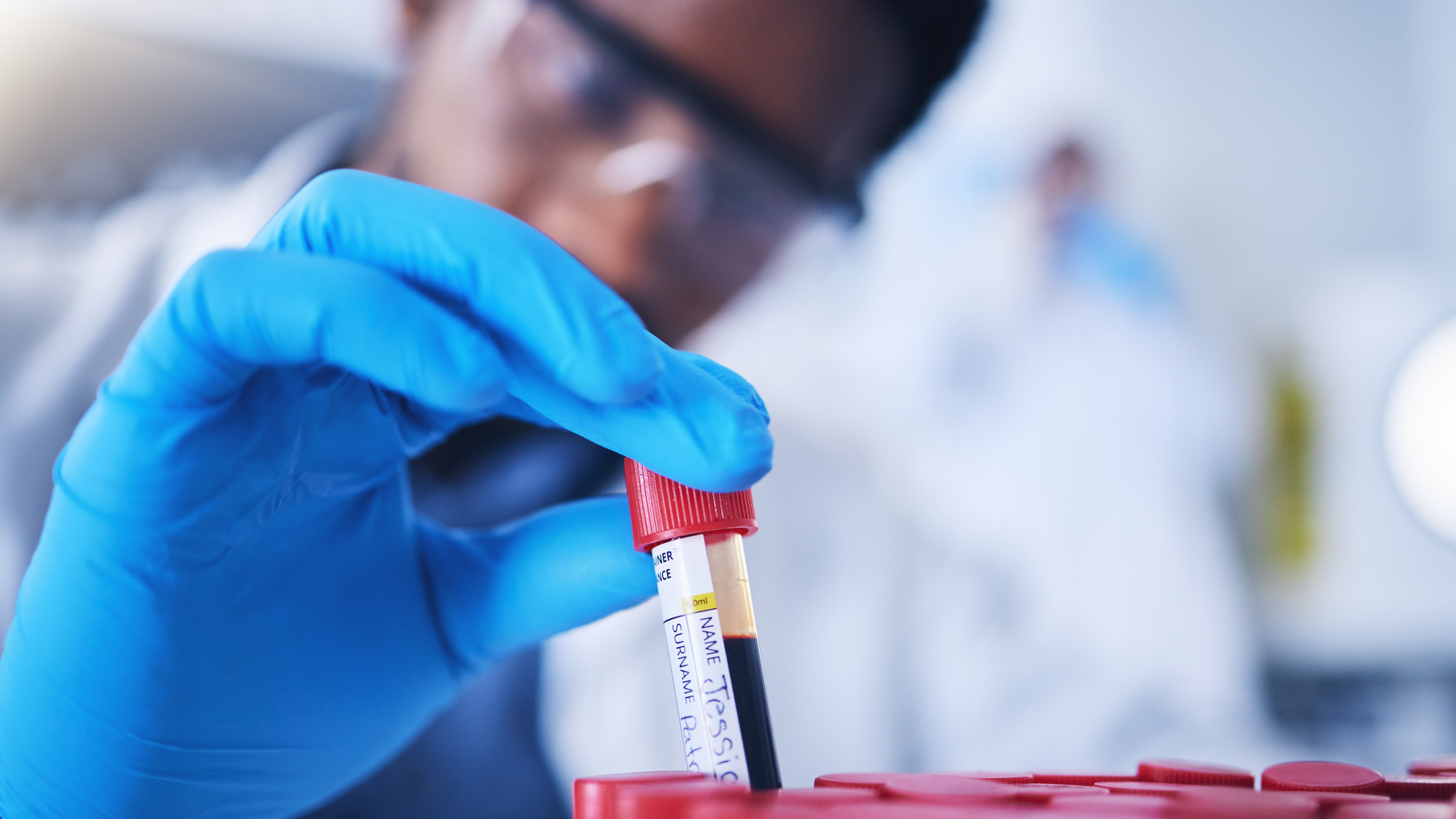 A lab technician putting a blood sample tube into a rack with other similar tubes.