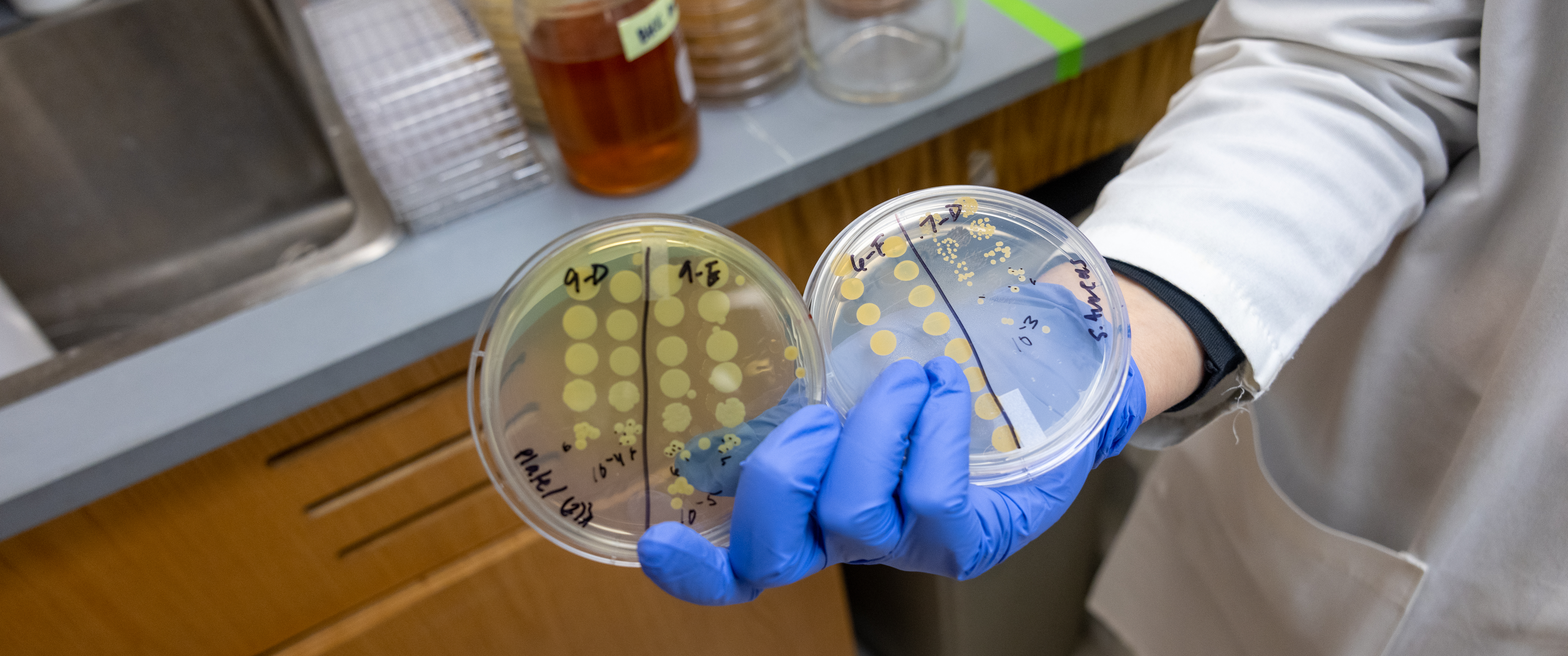 A gloved hand holds two petri dishes with microbes growing on them