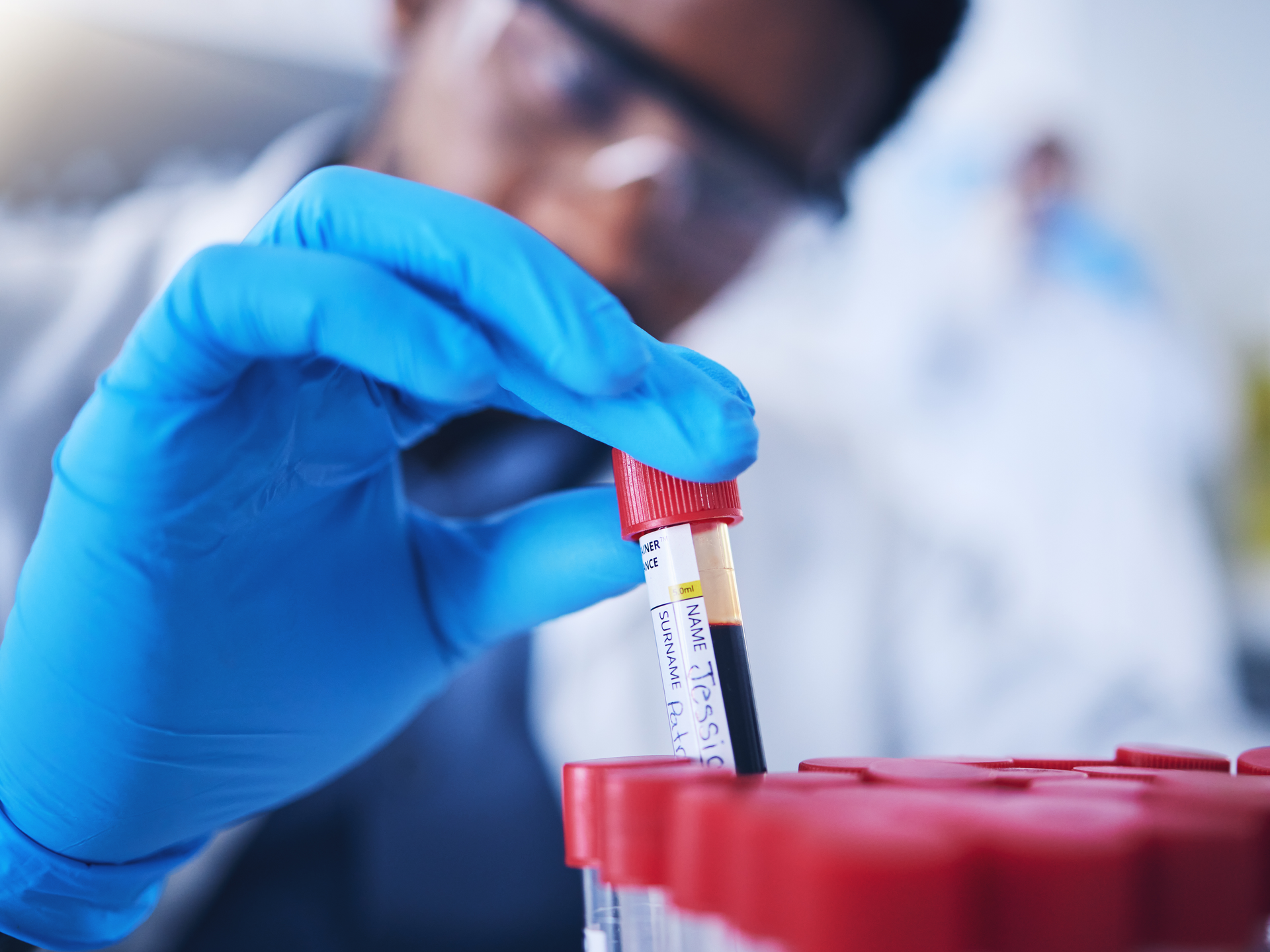 Researcher holding blood vial in lab
