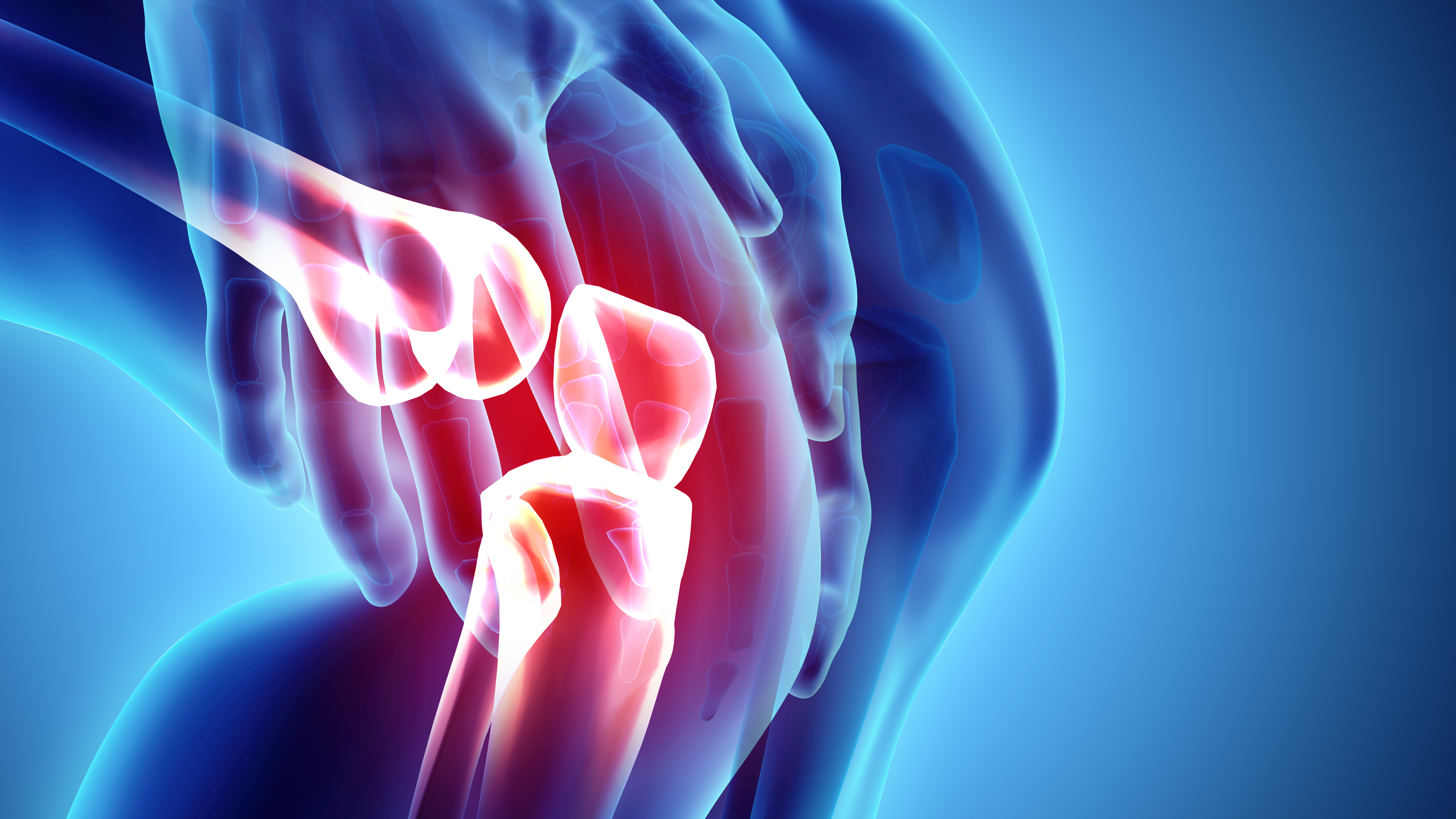 3D illustration of knee pain on skeleton xray