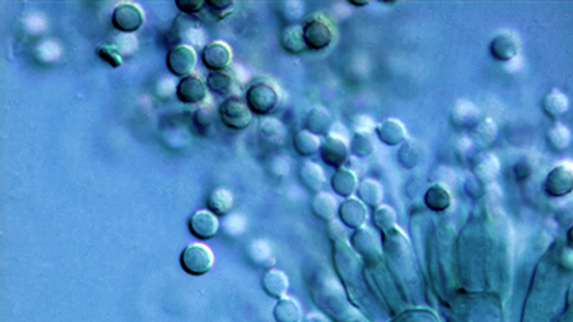 A high-scale magnification photograph of the conidia and conidiophores of a Penicillium species fungus