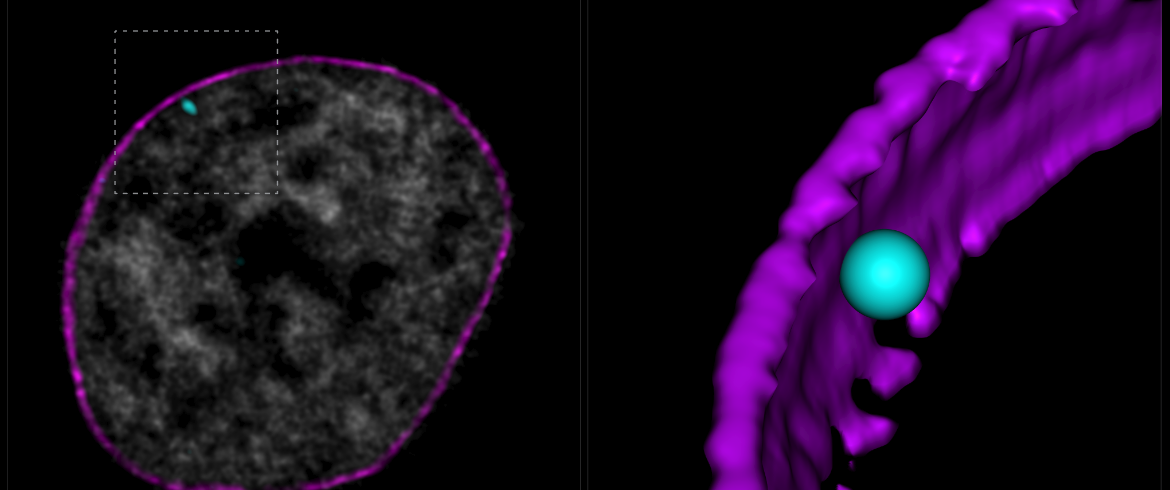 An FXN gene, in cyan, relative to the nuclear edge, in purple, in healthy and FRDA cells. The gene is positioned closer to the nuclear edge in FRDA cells