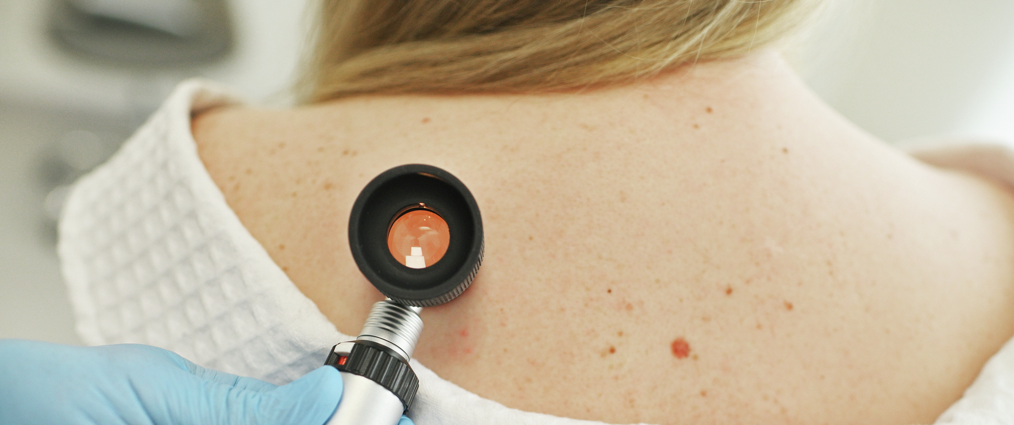 A doctor examining a patient's skin with a dermatoscope