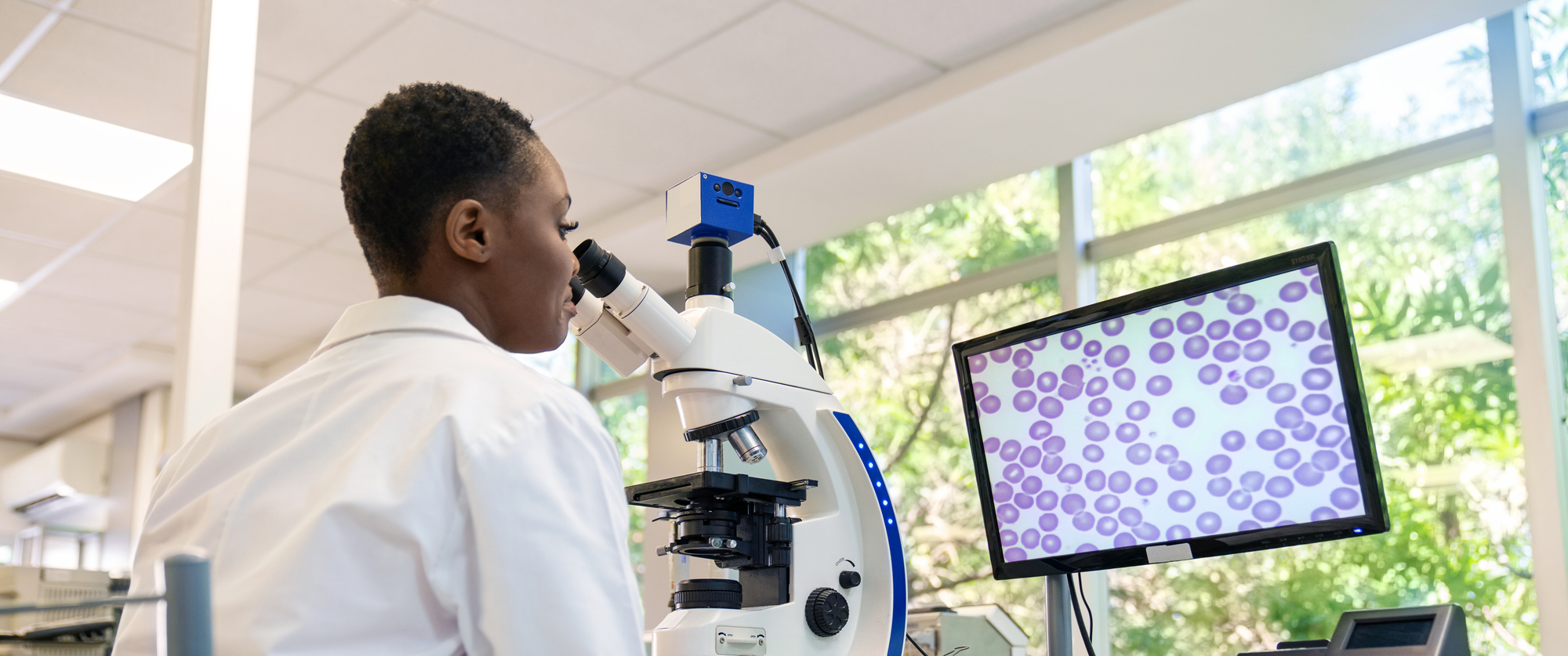 Researcher in lab coat looking at cells through microscope while image is displayed on monitor