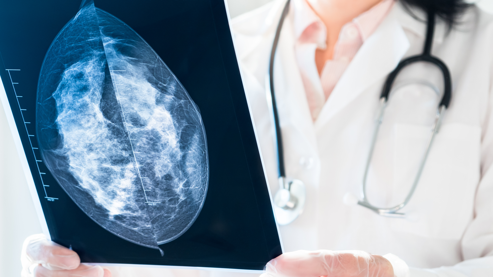 Female doctor looking at mammography results on x-ray.