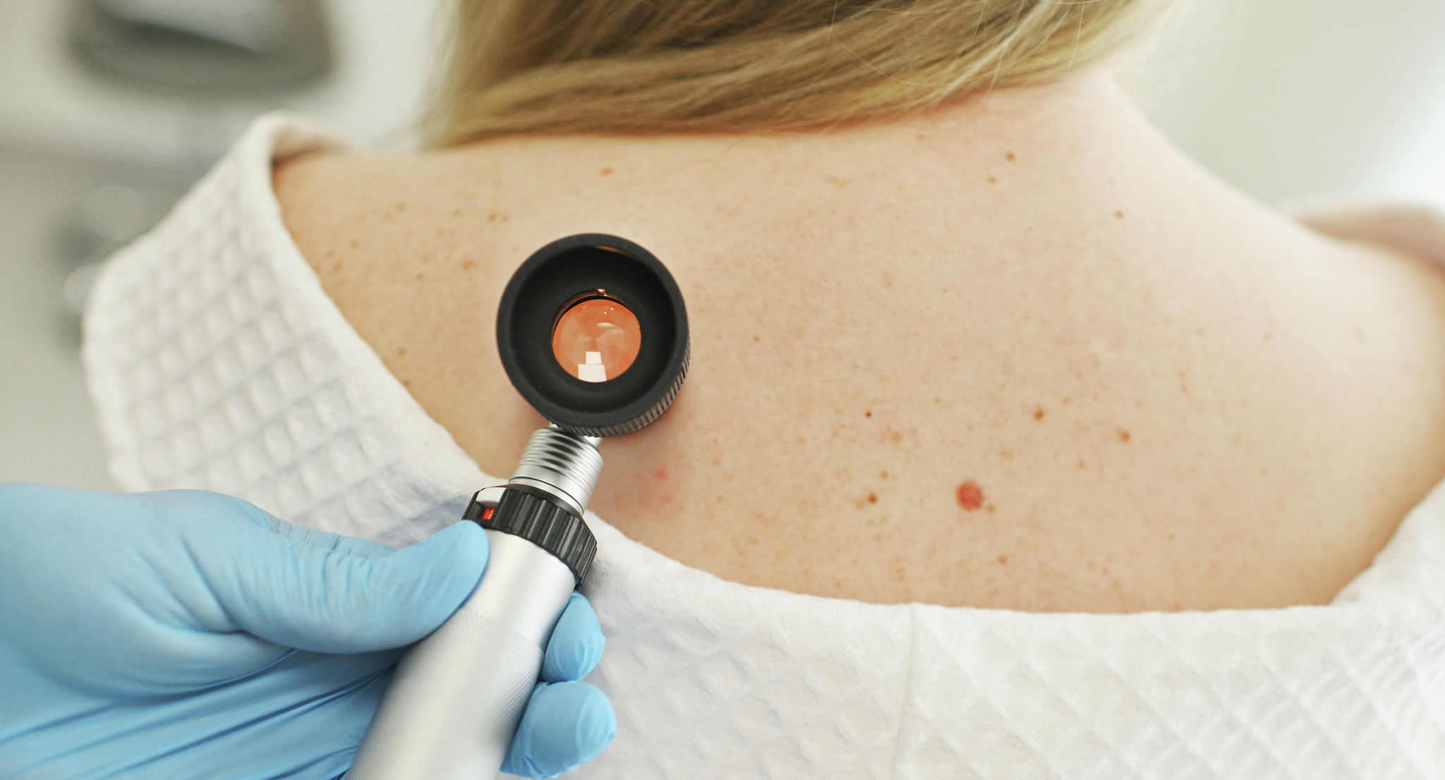 A doctor examining a patient's skin with a dermatoscope