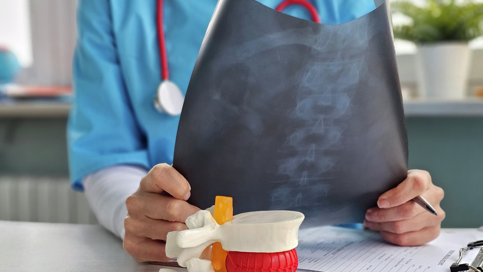 Doctor hold x-ray bone spine radiography in hand. Examination and treatment of intervertebral hernia. Traumatology tomography hospital radiographer.