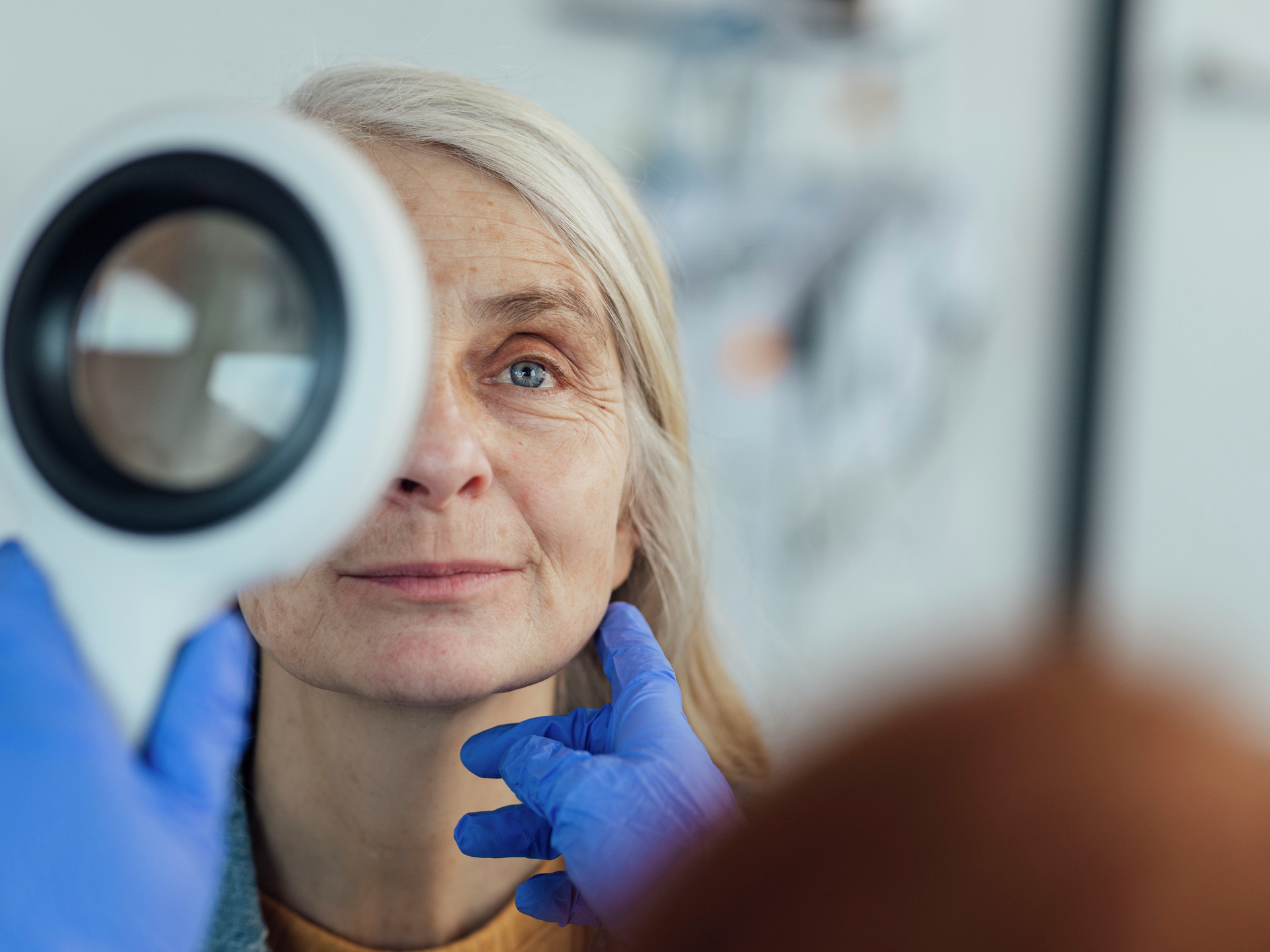 Close-up shot of a female doctor examining a patient's skin