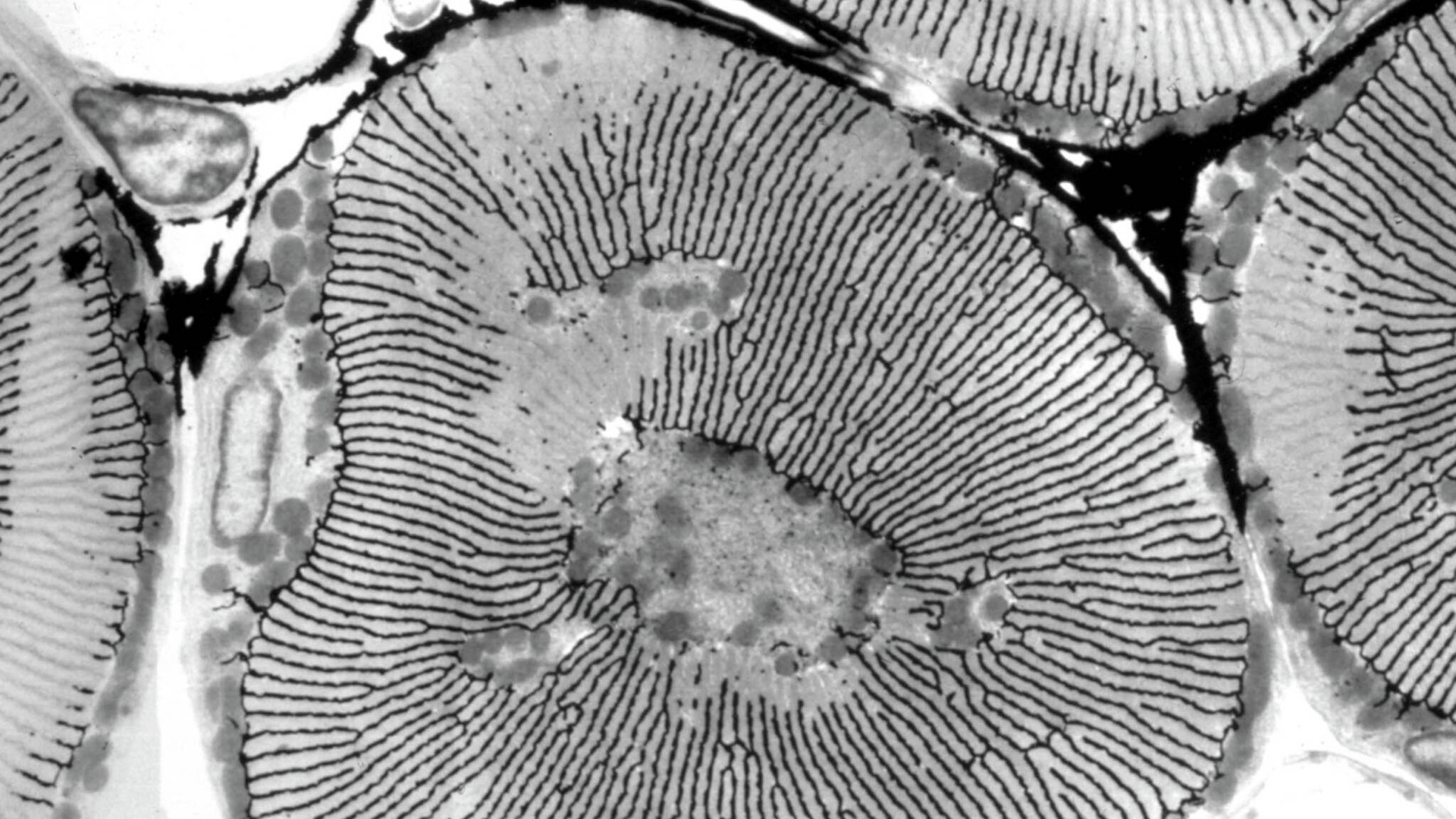 A black and white image from an electron microscope looks a bit like a fingerprint with multiple wavy parallel lines converging inside a roundish outer membrane.