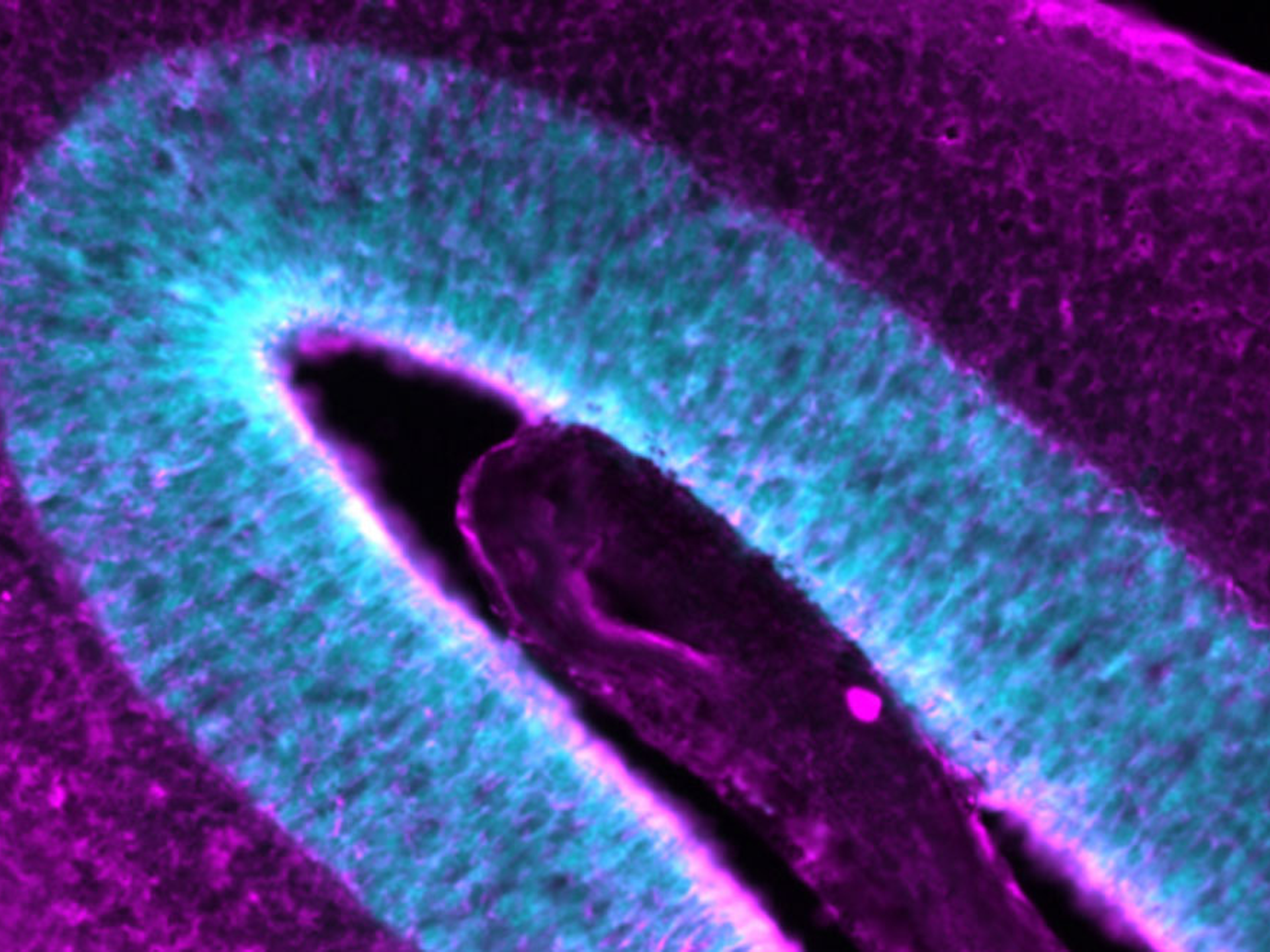 Mouse retina under microscope