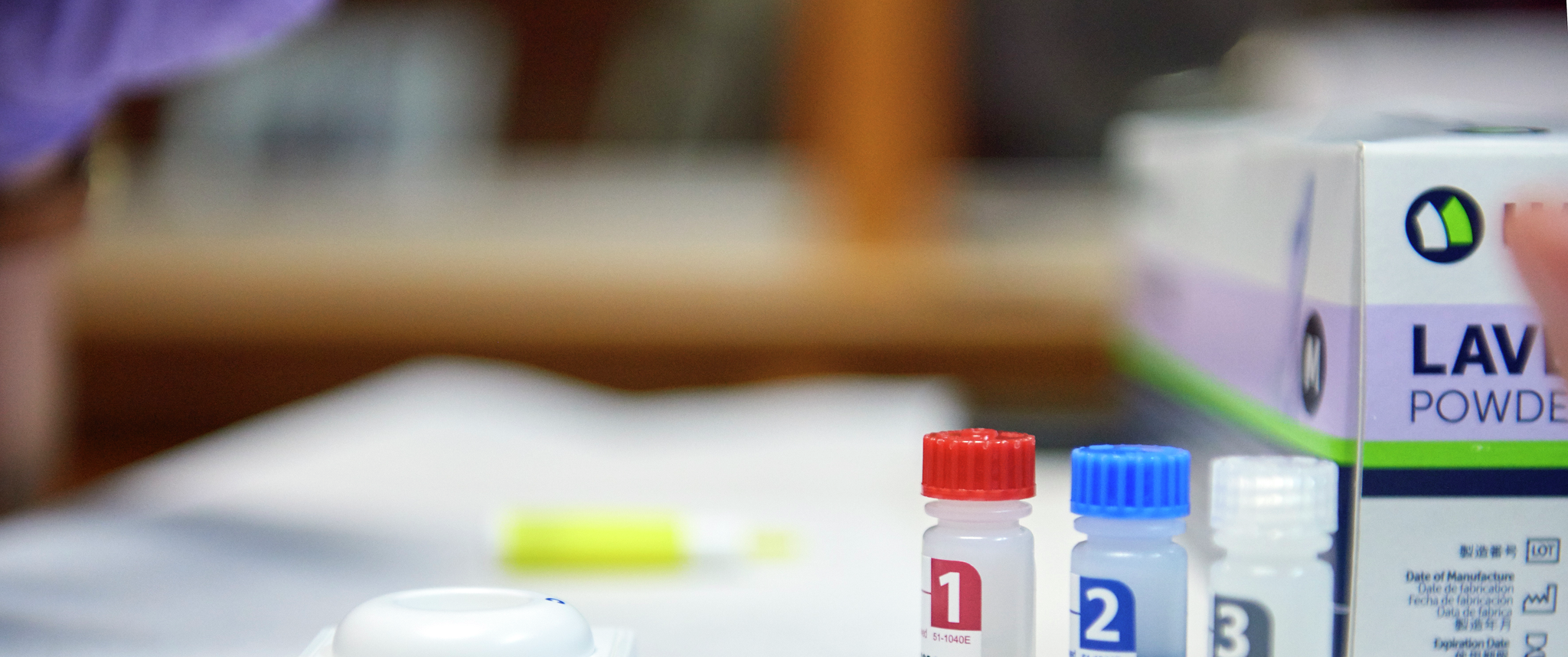 Three numbered vials arrayed on a table with a box for an HIV rapid test