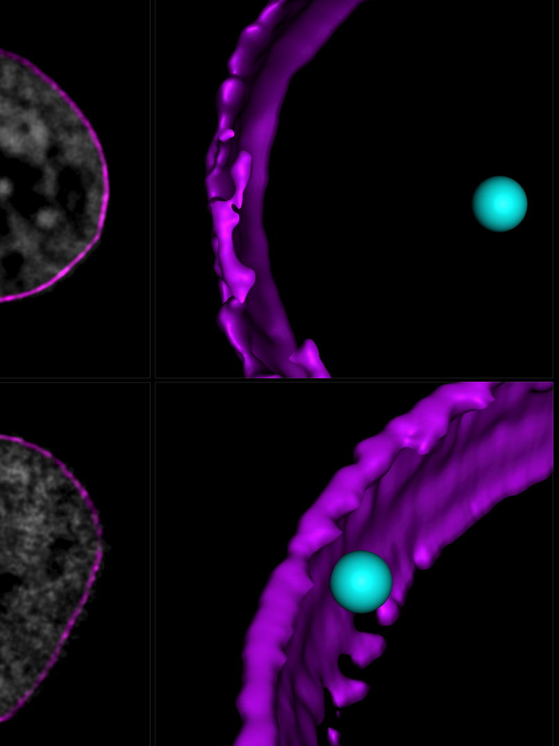 An FXN gene, in cyan, relative to the nuclear edge, in purple, in healthy and FRDA cells. The gene is positioned closer to the nuclear edge in FRDA cells