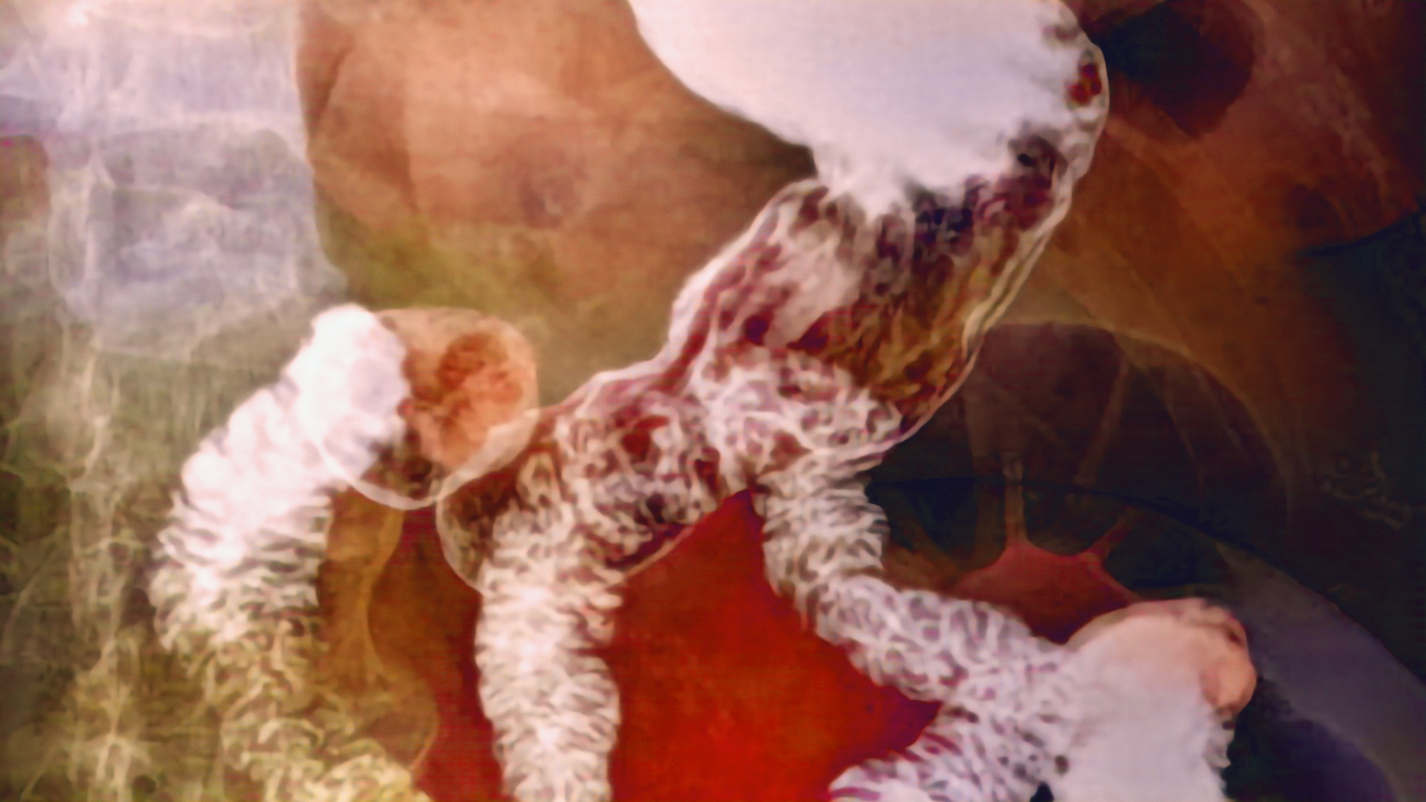 A barium x-ray shows a stomach herniating into the thoracic cavity with the gastroesophageal junction.