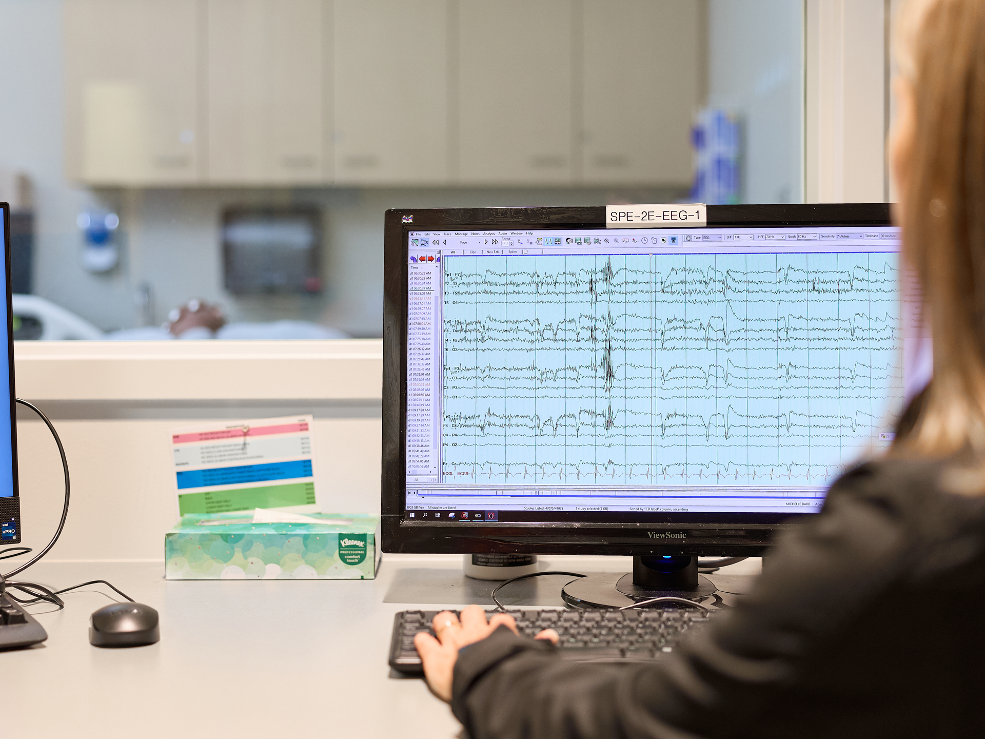 A nurse is looking at graph produced by an EEG in a monitoring room