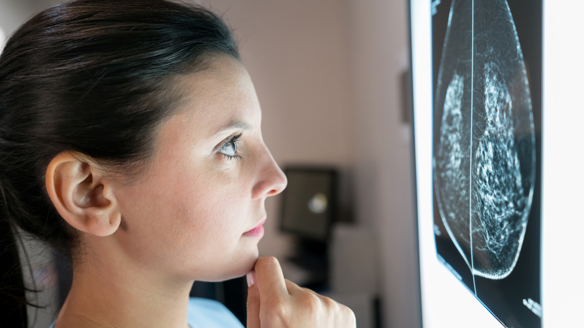 Female gynecologist at the hospital looking at a mammogram very concerned