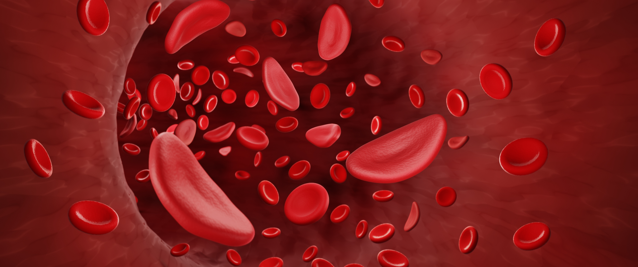 Illustration of red blood cells affected by sickle cell anaemia