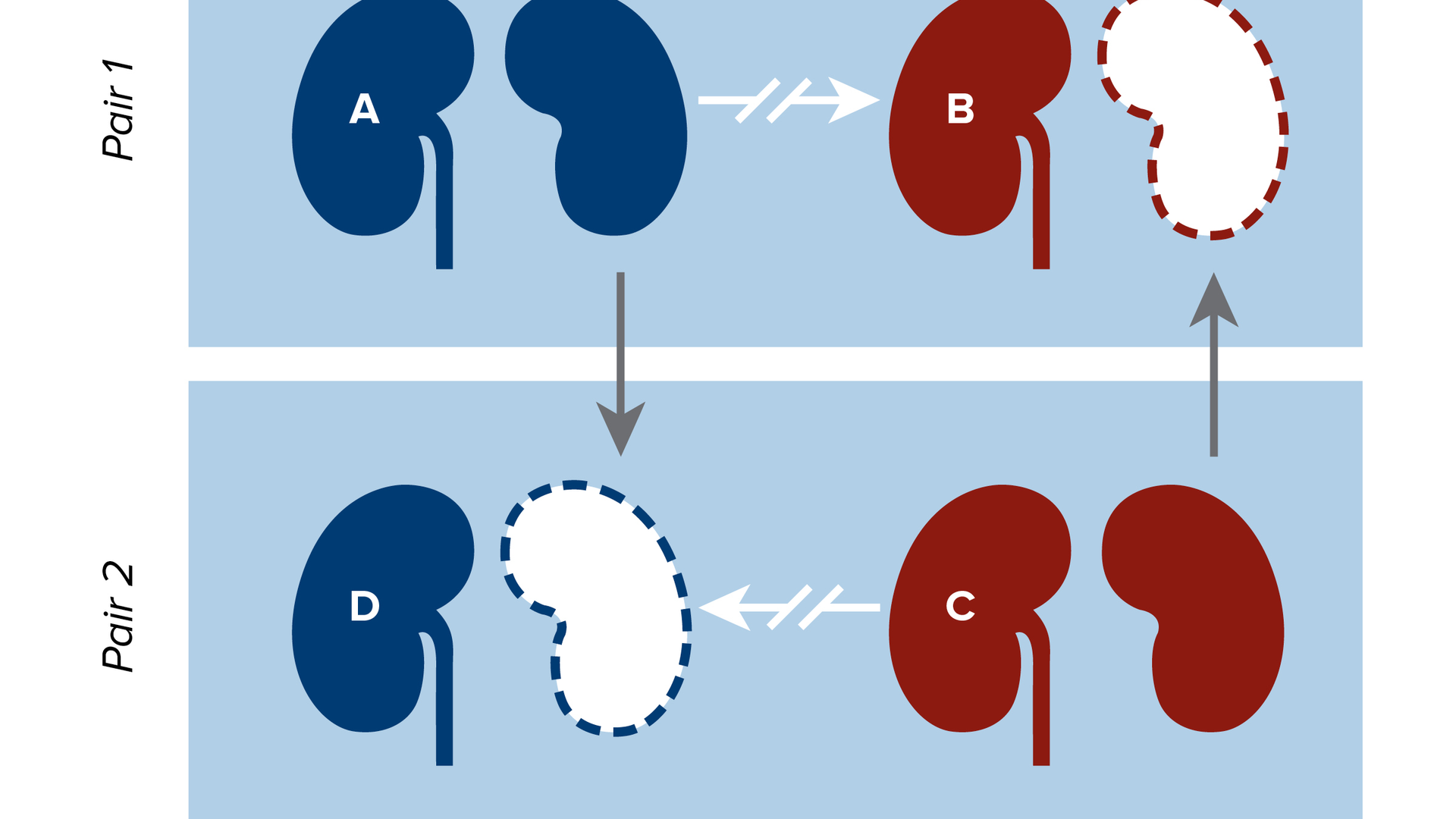 A chart illustrating how non-directed (altruistic) donors may choose to participate in kidney-paired donation to initiate a chain of transplants