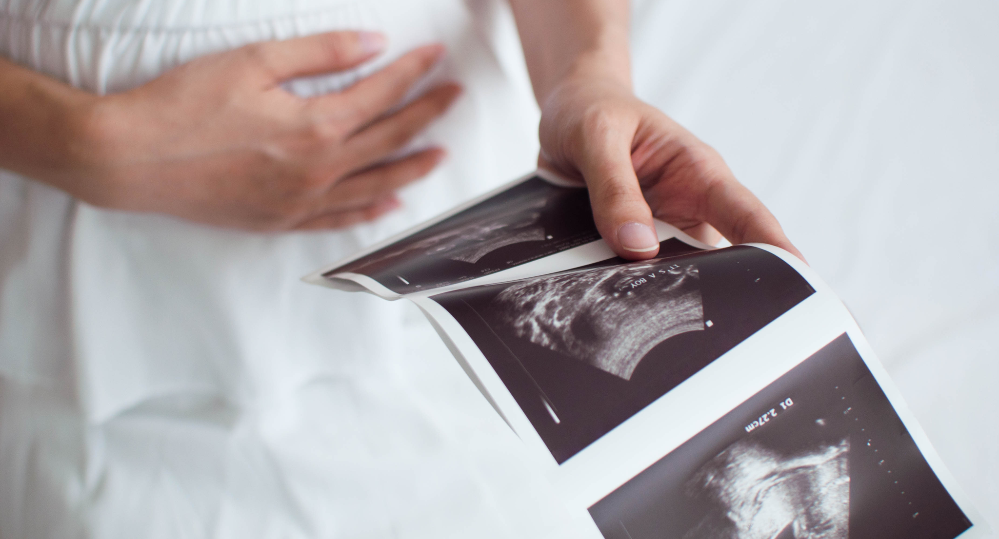 Pregnant woman is holding an ultrasound scan result