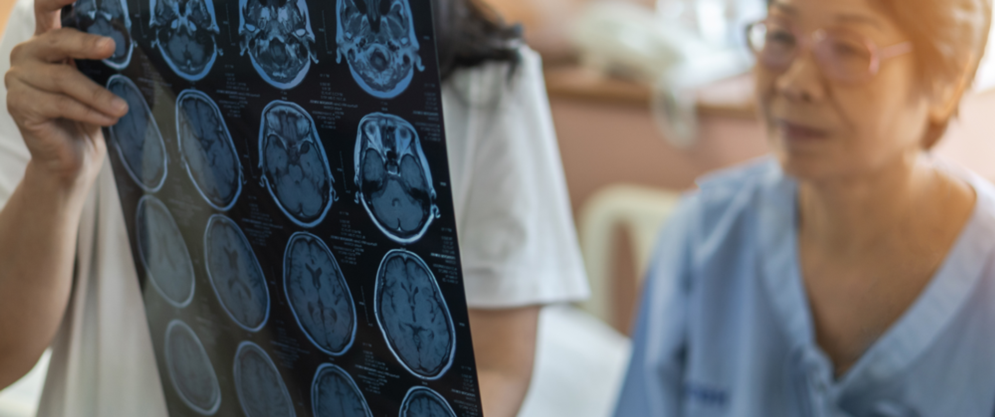 Medical personnel show series of brain MRI images to elderly Asian American patient