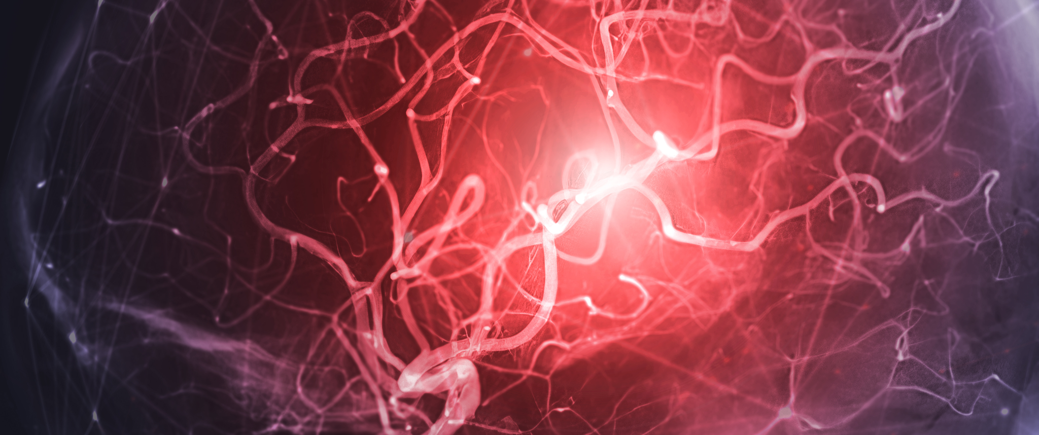 Cerebral angiography image from Fluoroscopy in intervention radiology showing cerebral artery.