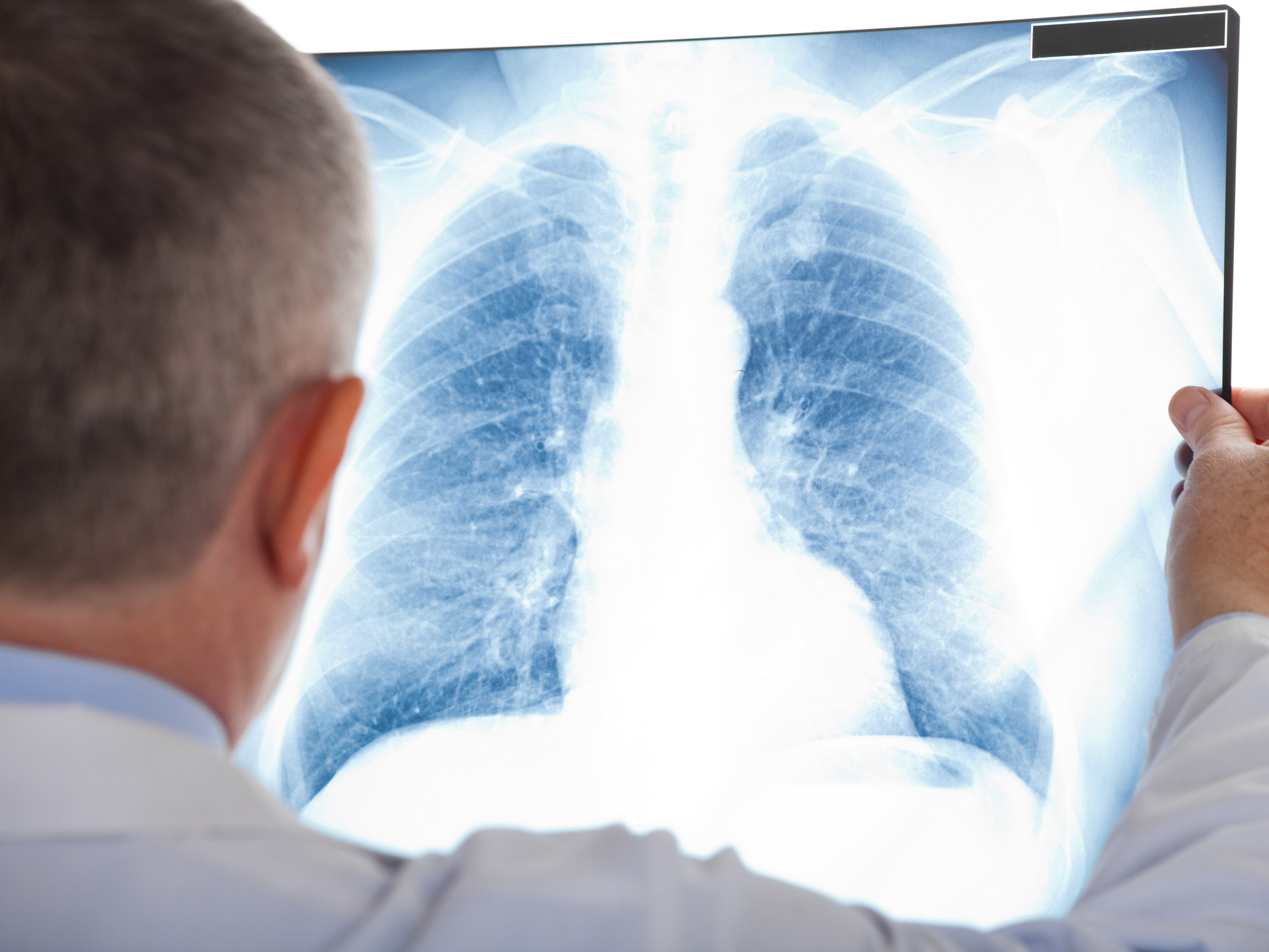 Doctor looking at lung xray.jpg
