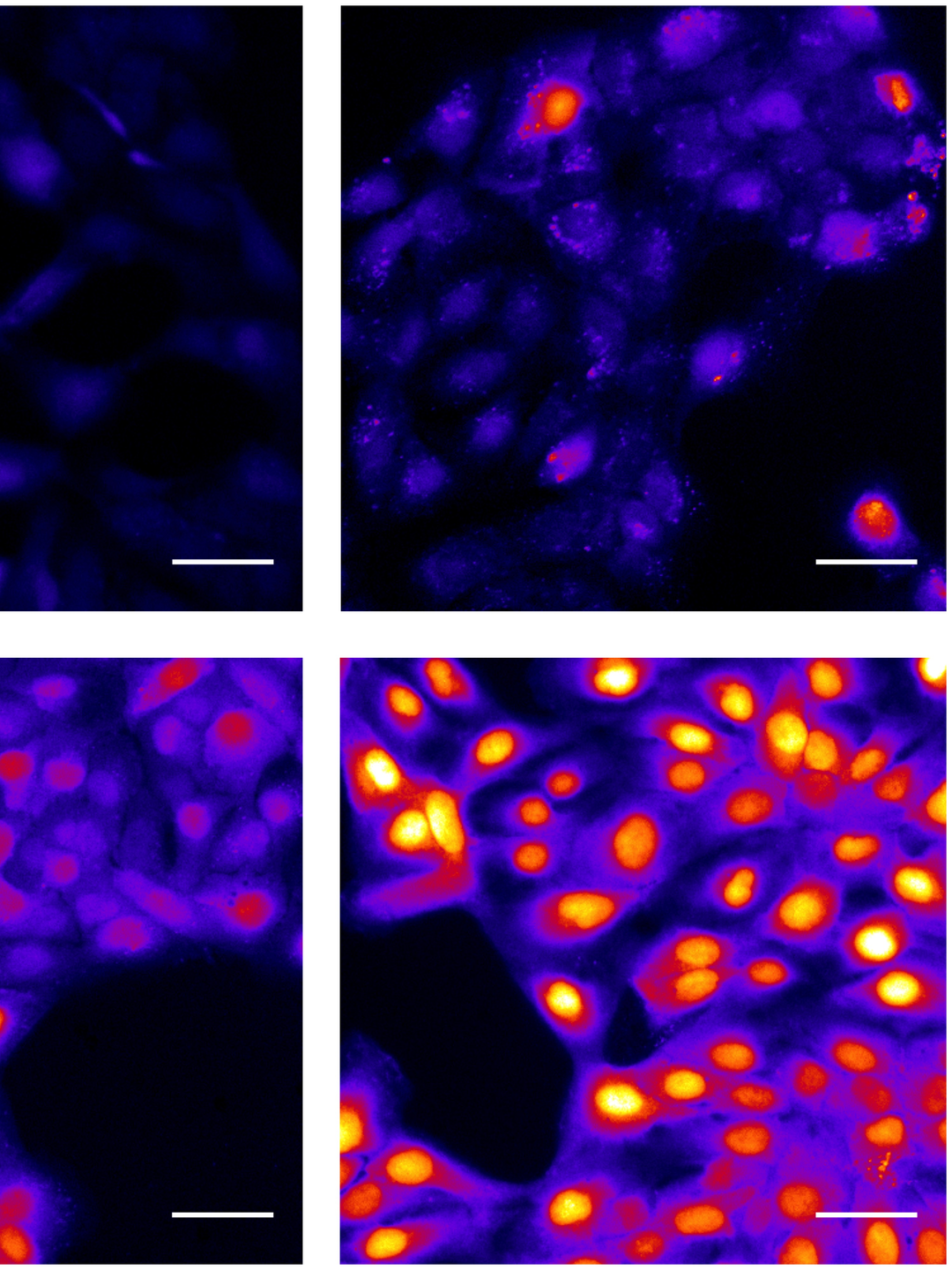 Cell images in four quadrants show a range of levels of bright orange spots in the center of cells, from fully dark (no spots) in the upper left to extremely bright yellow/orange spots in most cells at lower right