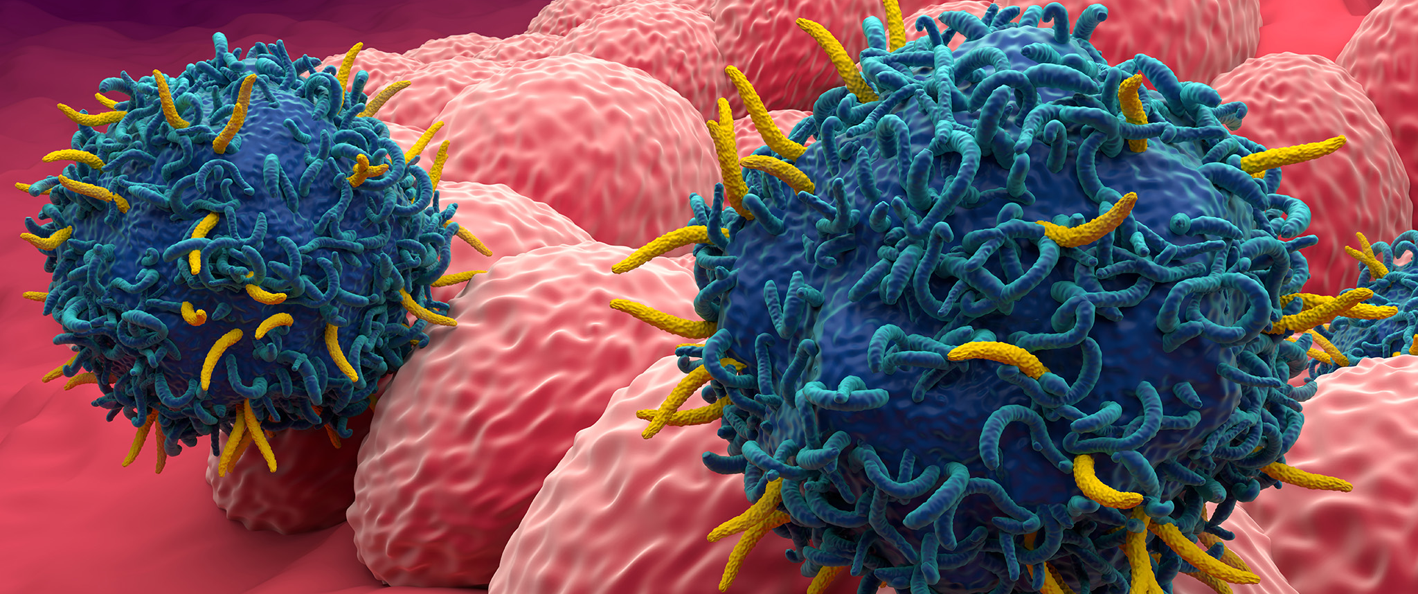 AR T cells interacting with endometrial cancer cells