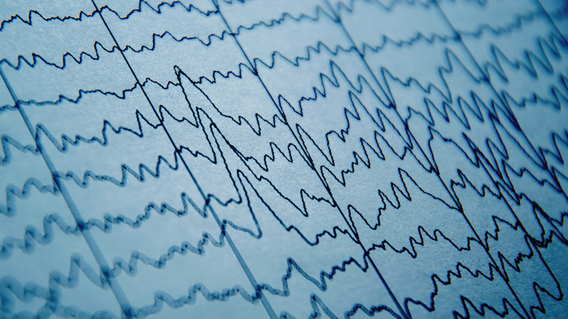 An EEG read-out is shown