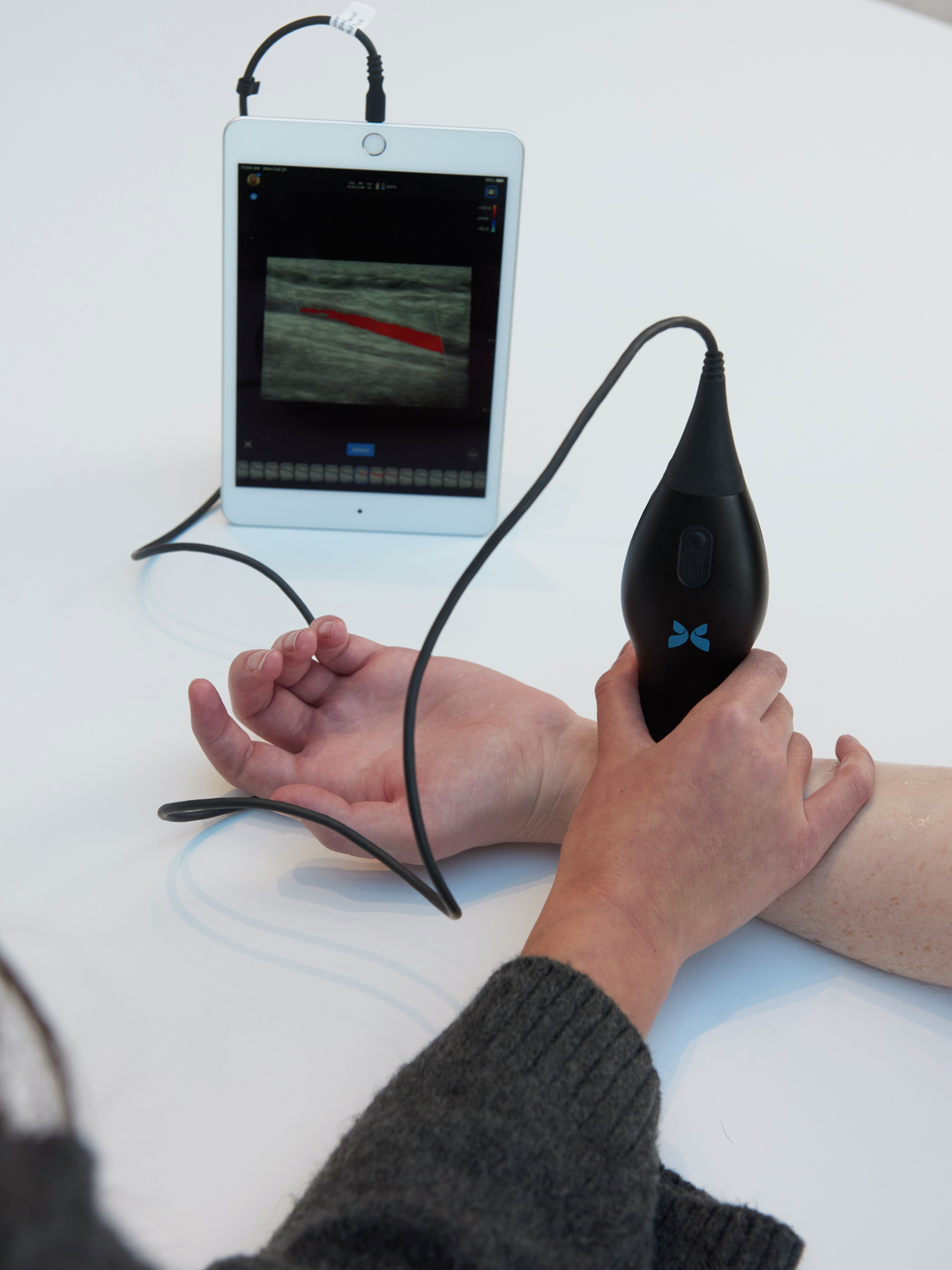 A handheld ultrasound wand is held over a person's wrist, with a display of the ultrasound image on an attached tablet