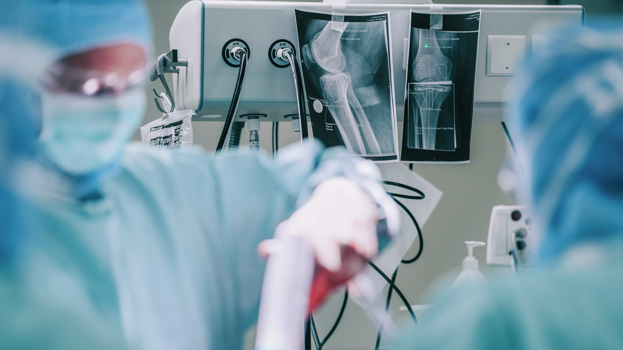Surgeons in hospital operating room with knee x-ray image behind them