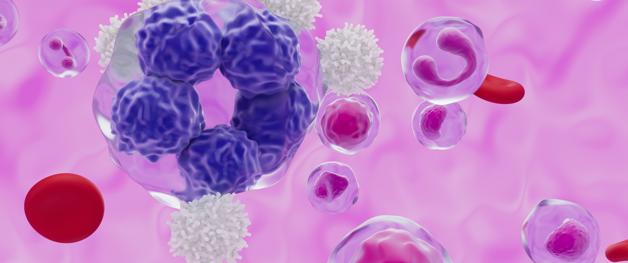 An artistic rendering of a multinucleated lymphoma cell within a blood flow environment.