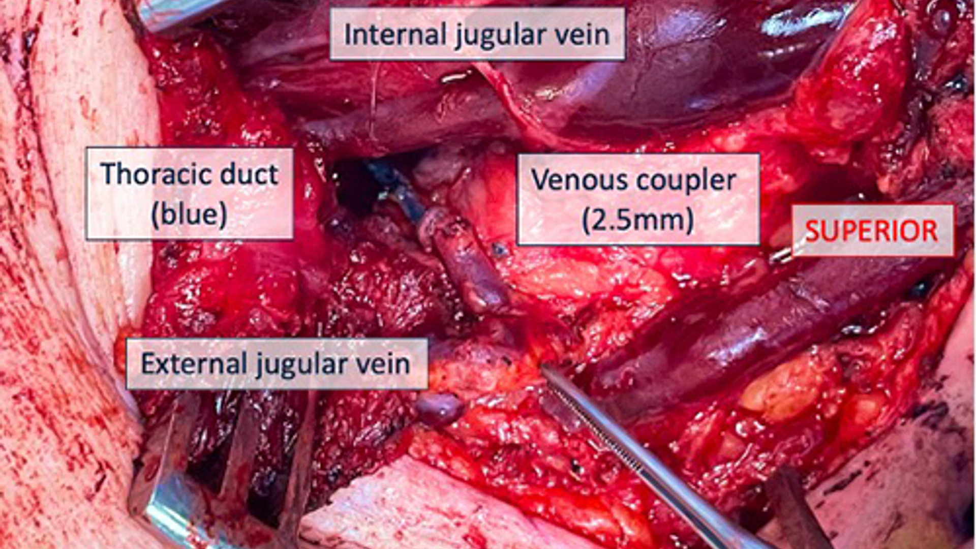Surgical field with legends