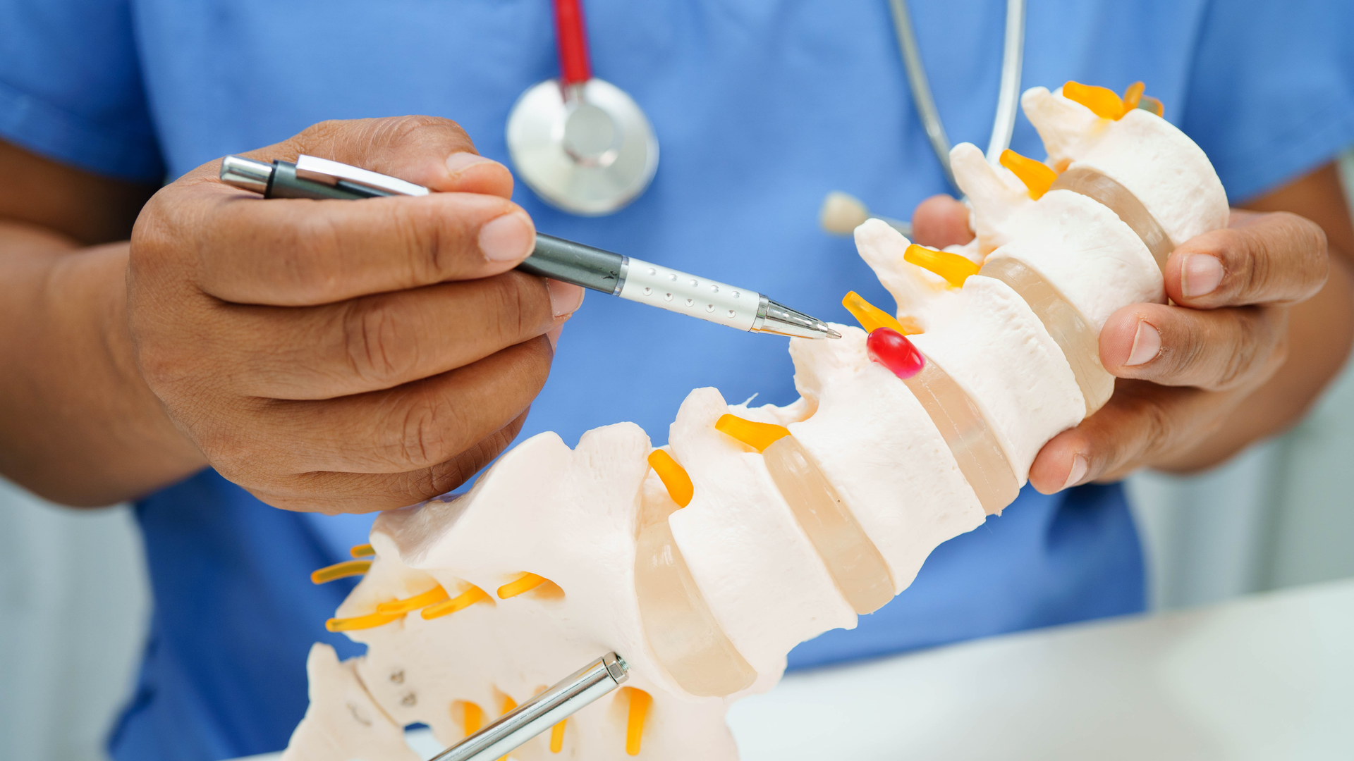 Doctor holding spinal nerve and bone model, Lumbar spine displaced herniated disc fragment for treatment medical in the orthopedic department.