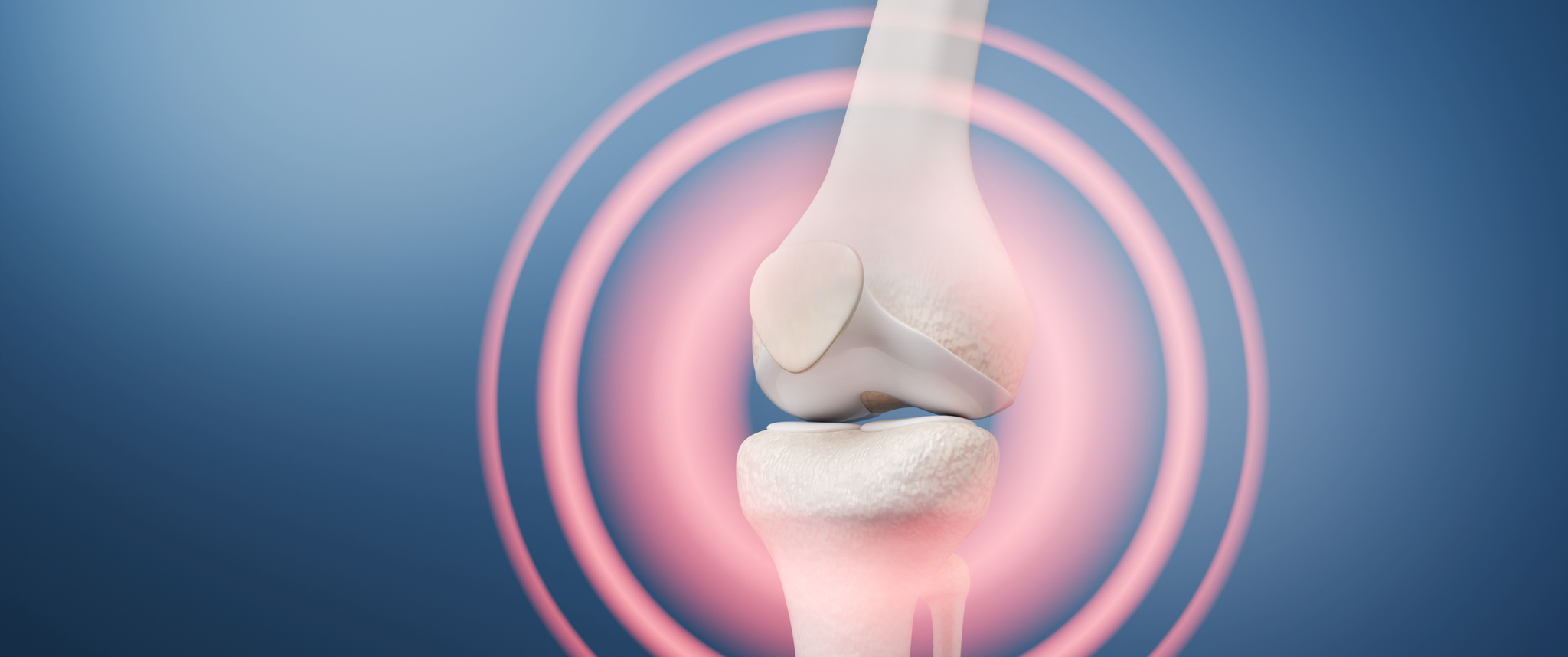 A digital illustration depicting knee joint bone pain 