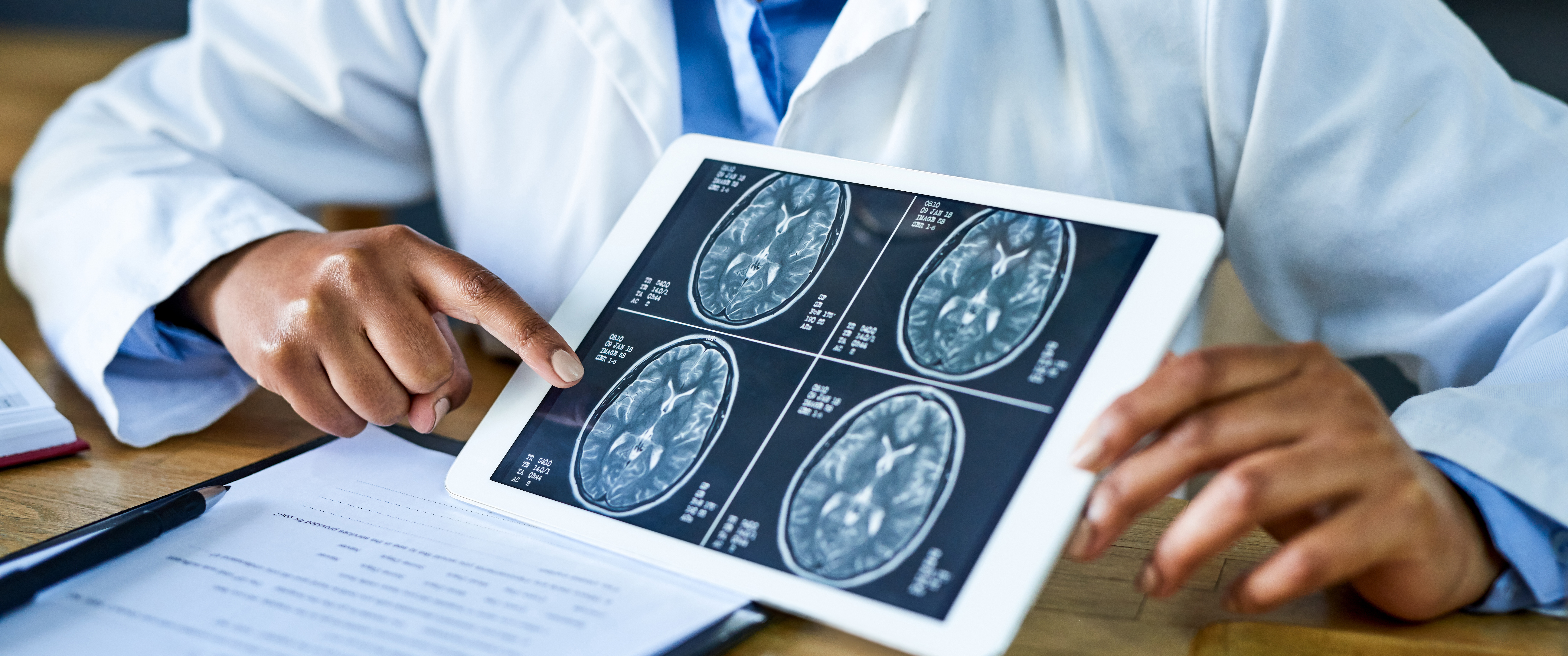 A doctor points to a brain scan on a tablet