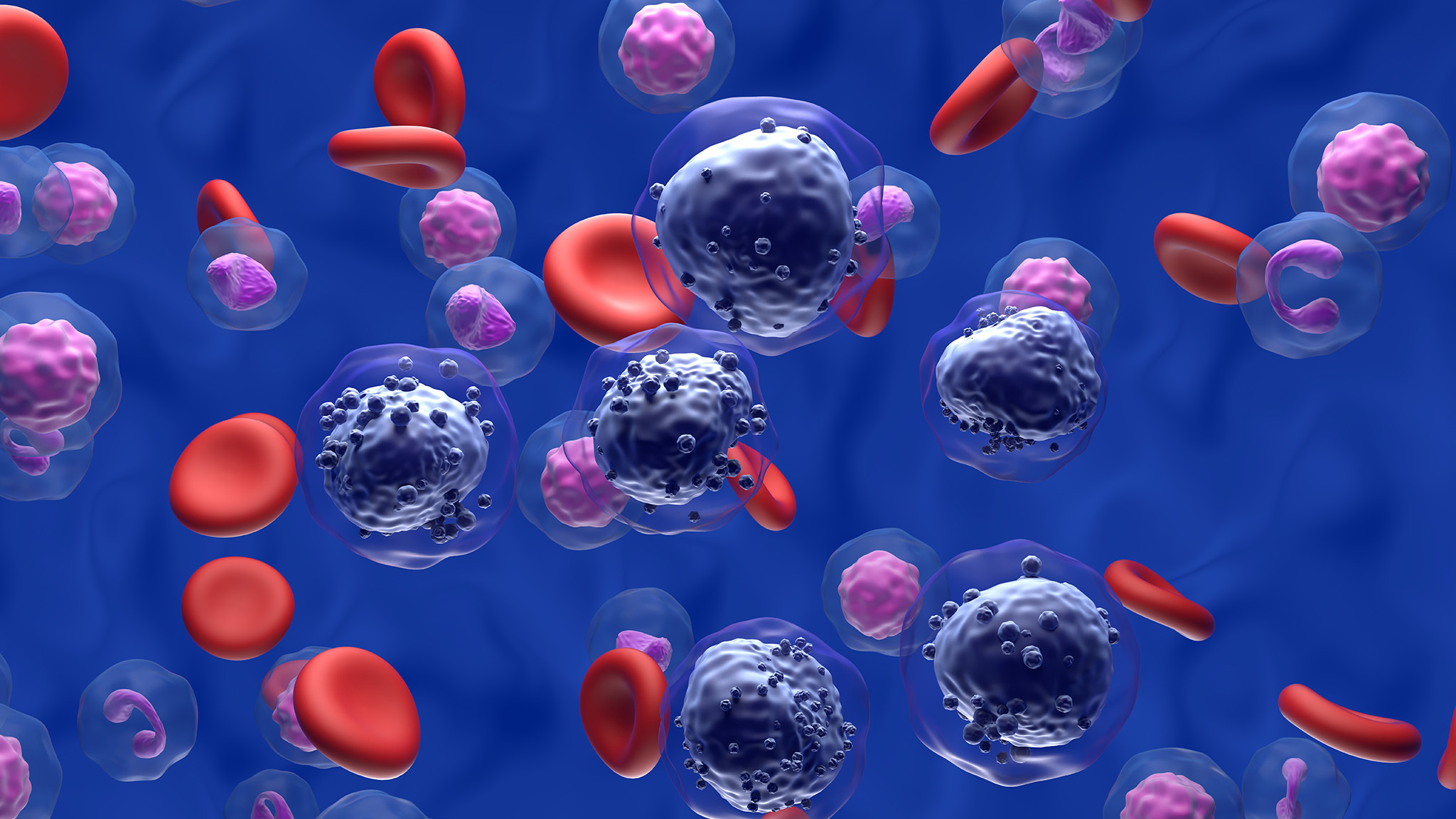 An abnormal number of myeloid cells in the blood overwhelming healthy red blood cells.