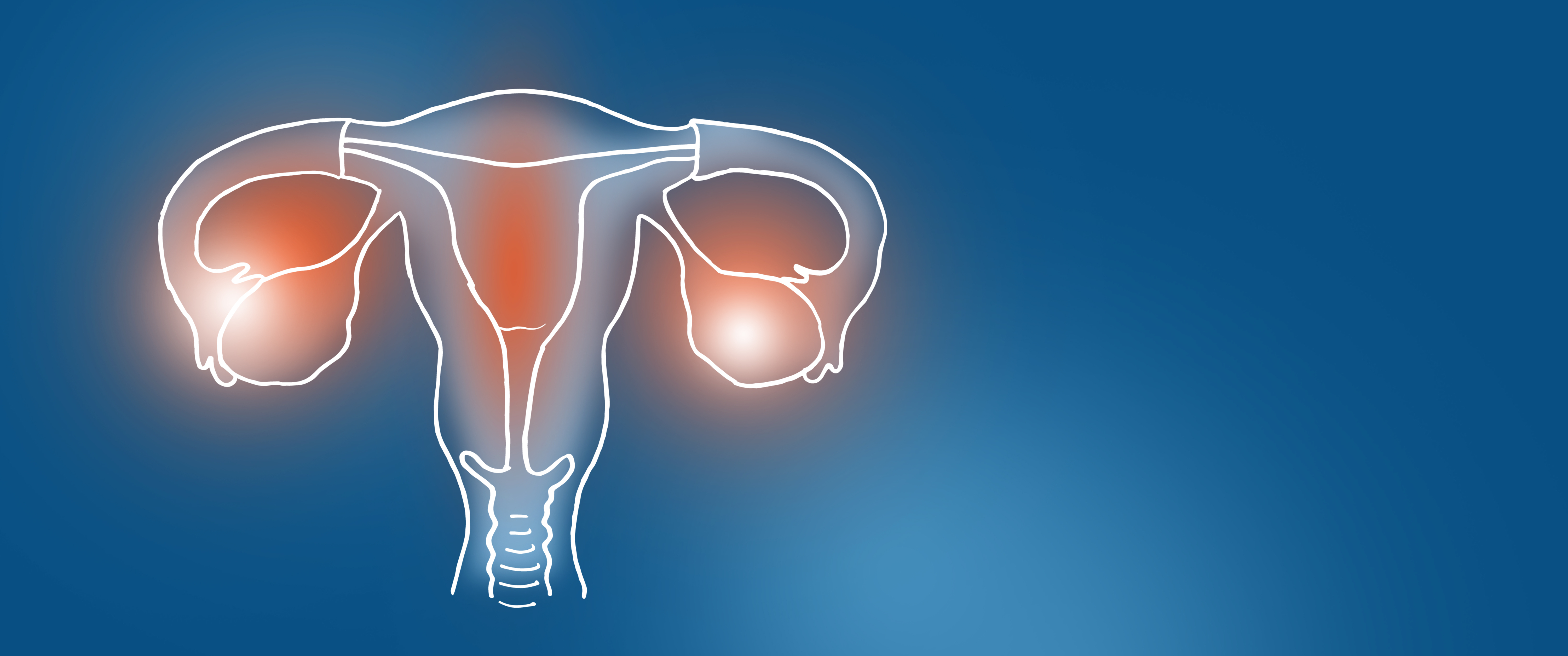 An illustration of a uterus diagram