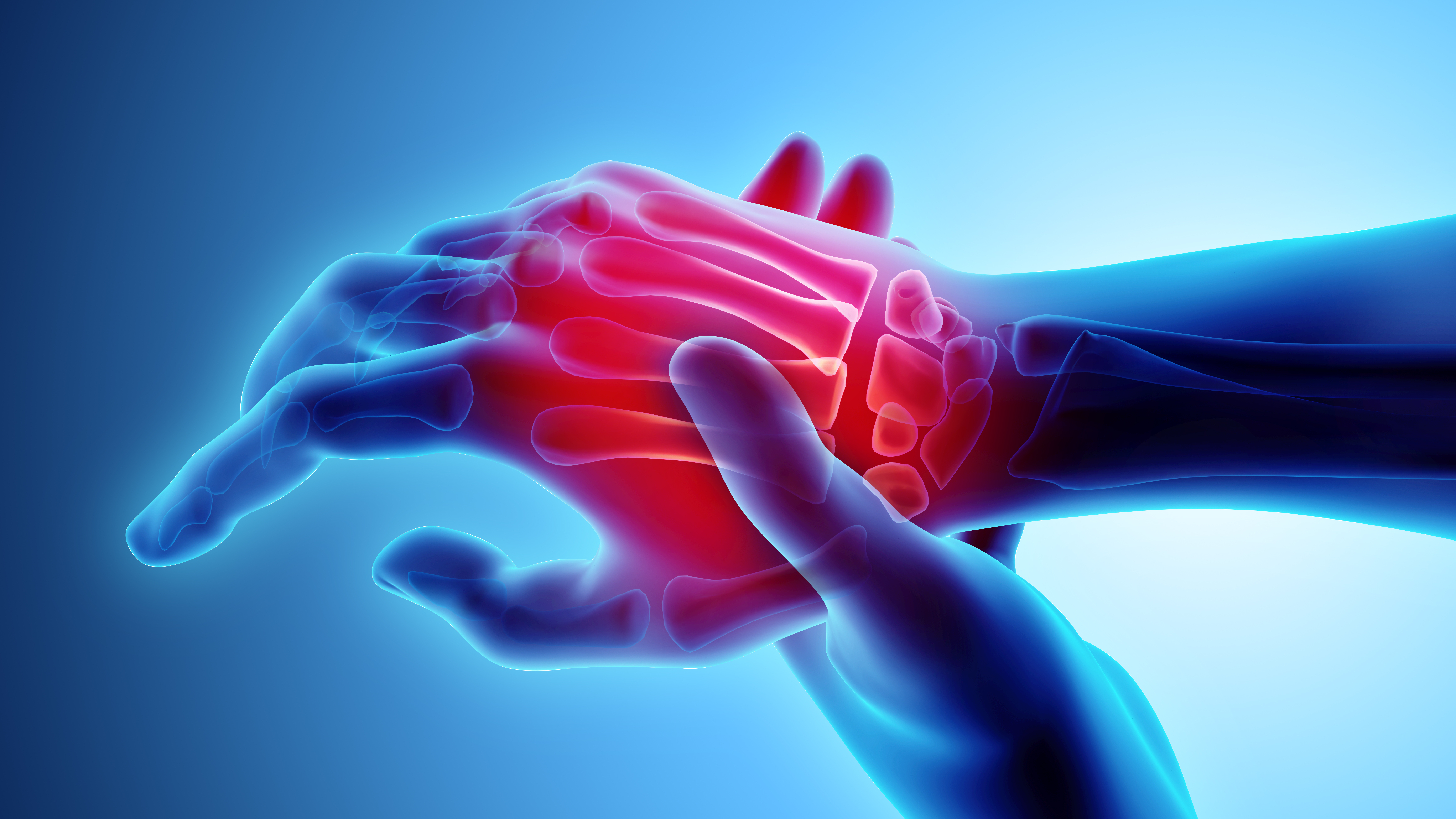 3D illustration of hand and wrist pain on skeleton xray
