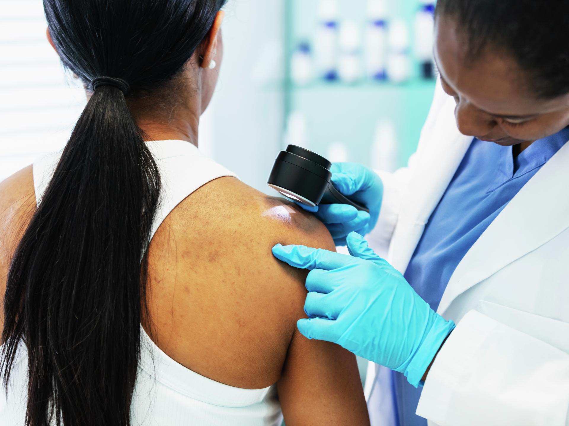  Patient sitting on an examination table while doctor examines the skin on her shoulder with a dermascope.