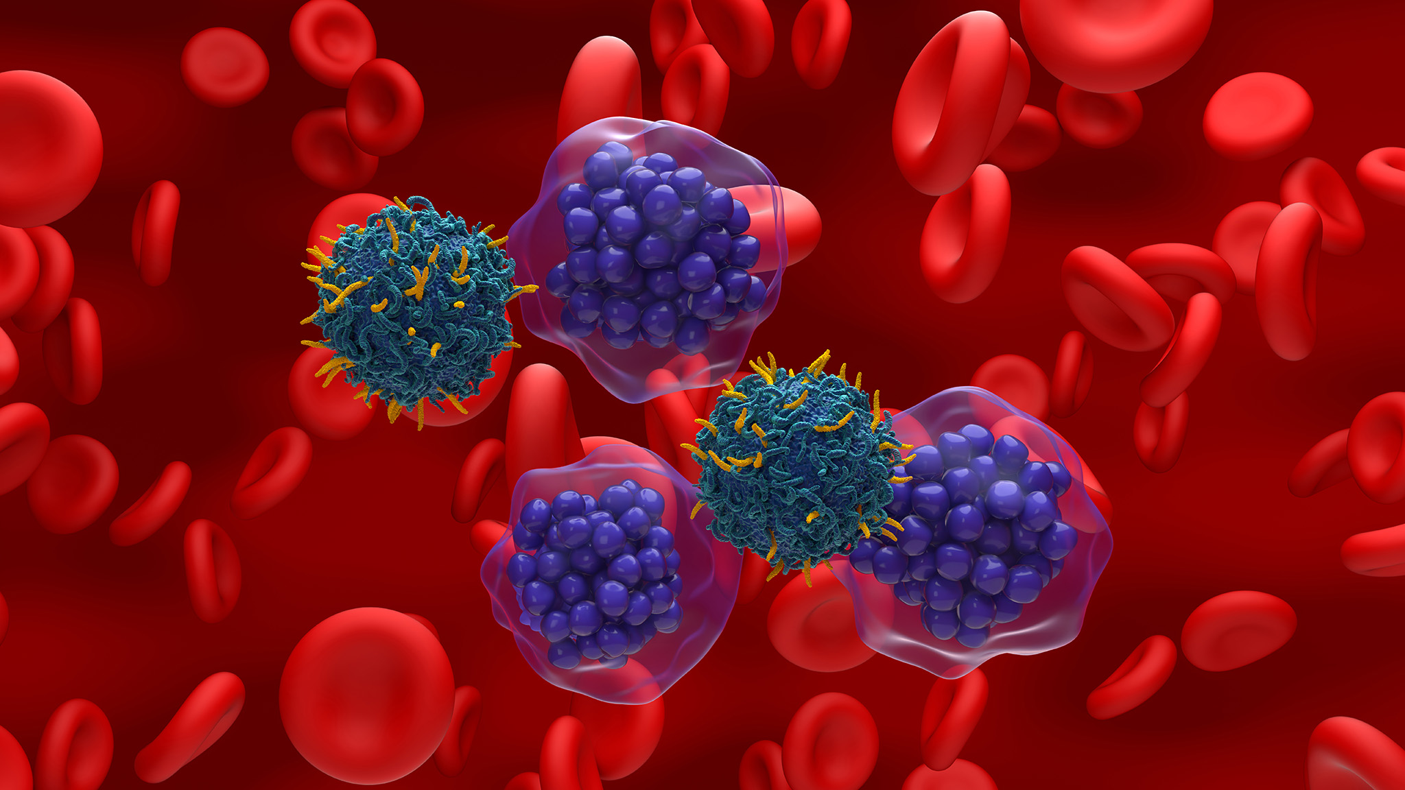 Advances in lymphoma treatment therapies and clinical trials | Penn ...