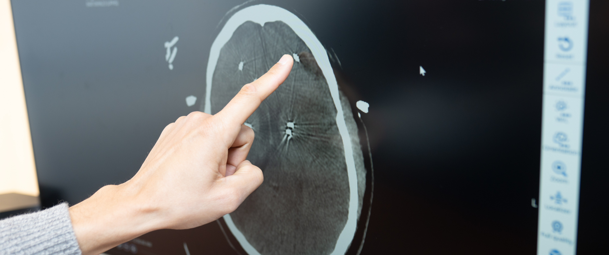 A person pointing at a brain scan on a monitor