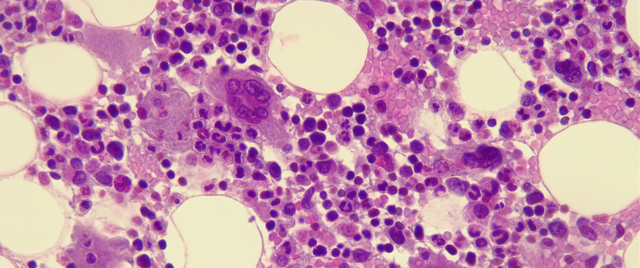 Bone marrow under a microscope