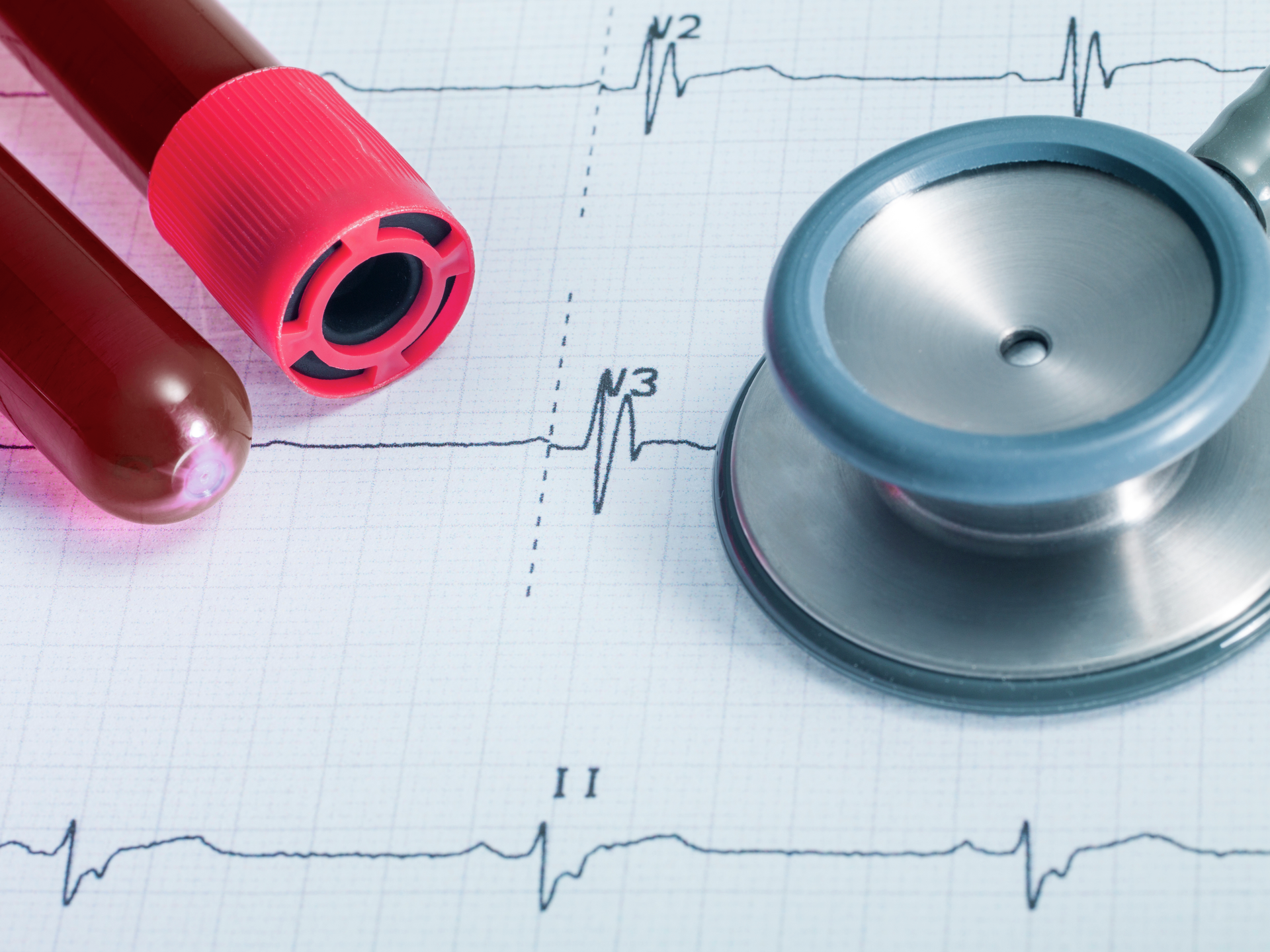 Stethoscope on EKG and blood sample test tubes