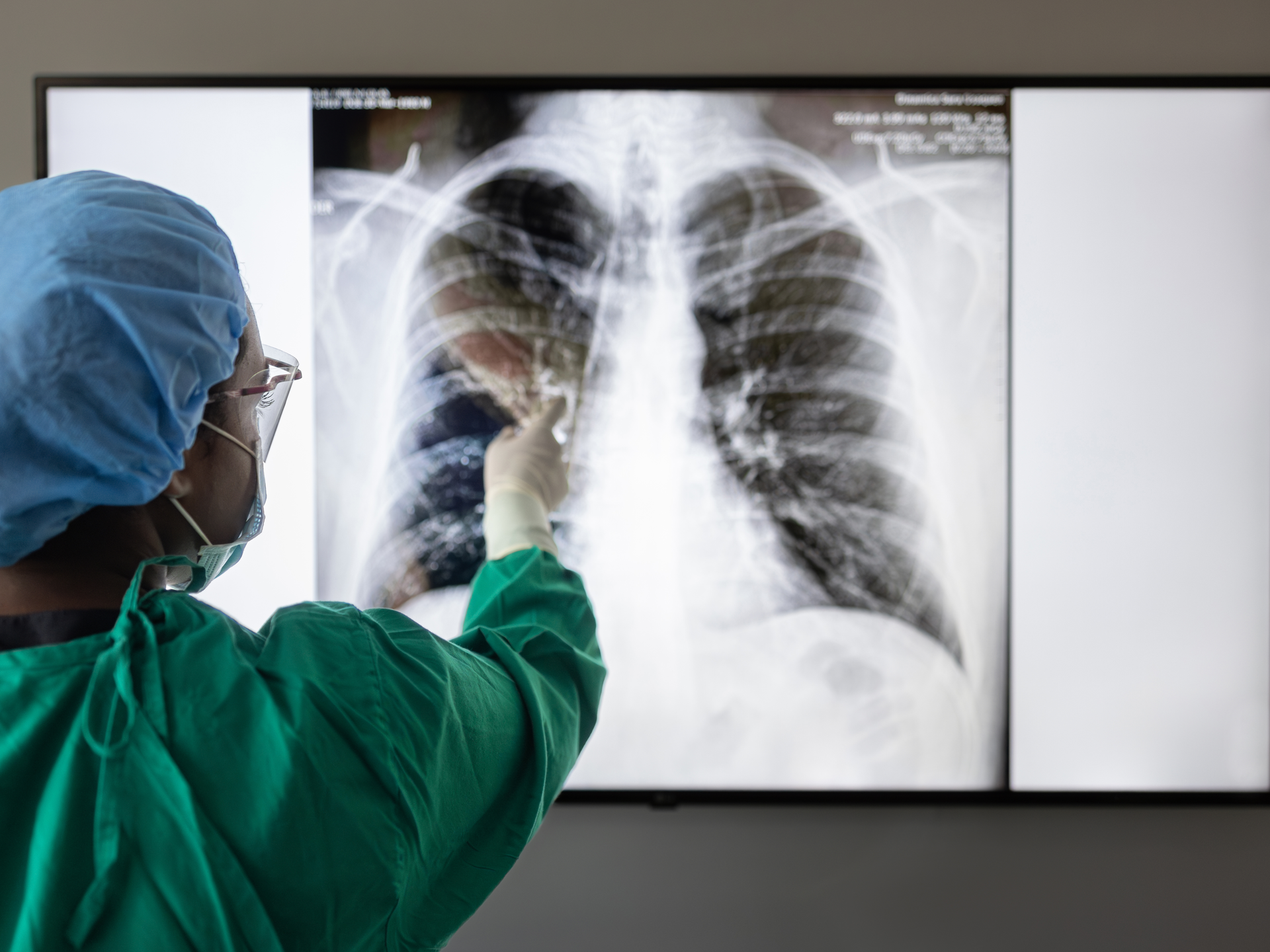 Provider reading a scan of lungs