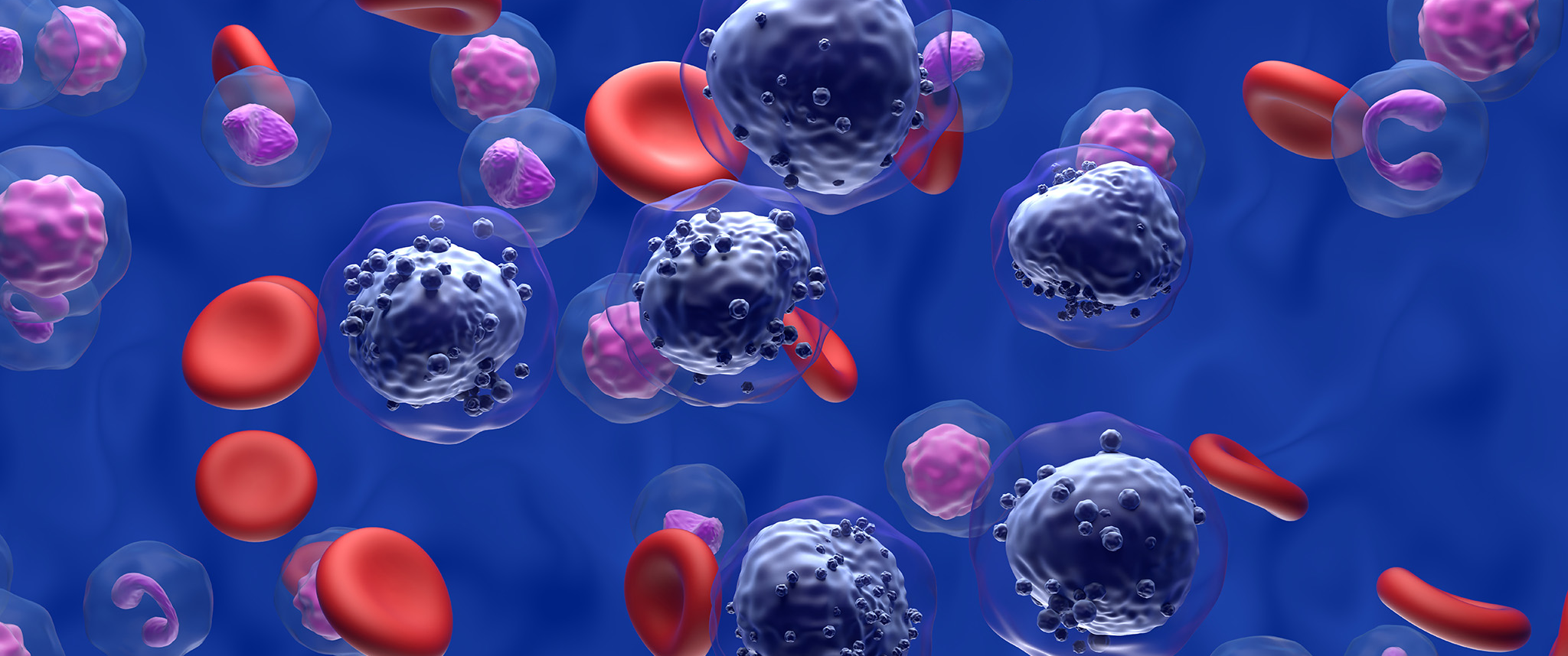 An abnormal number of myeloid cells in the blood overwhelming healthy red blood cells.
