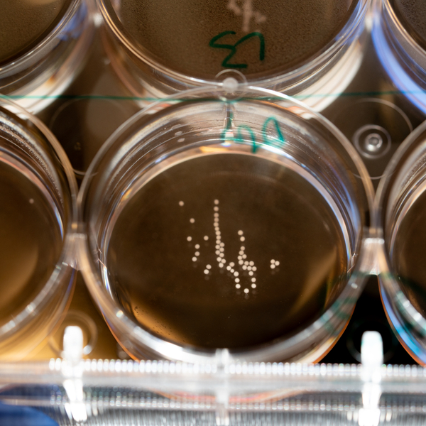 Round dishes, each containing tiny white spheres that are brain organoids in a fluid medium