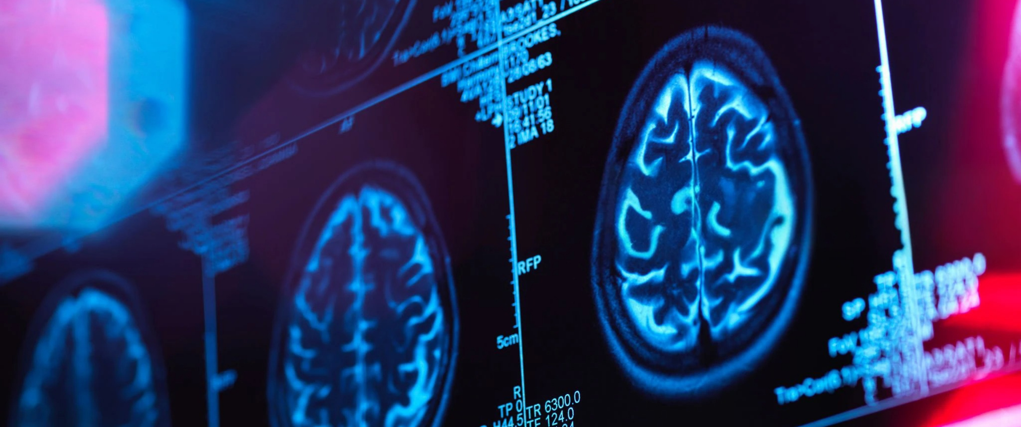 A close-up of a blue brain scan