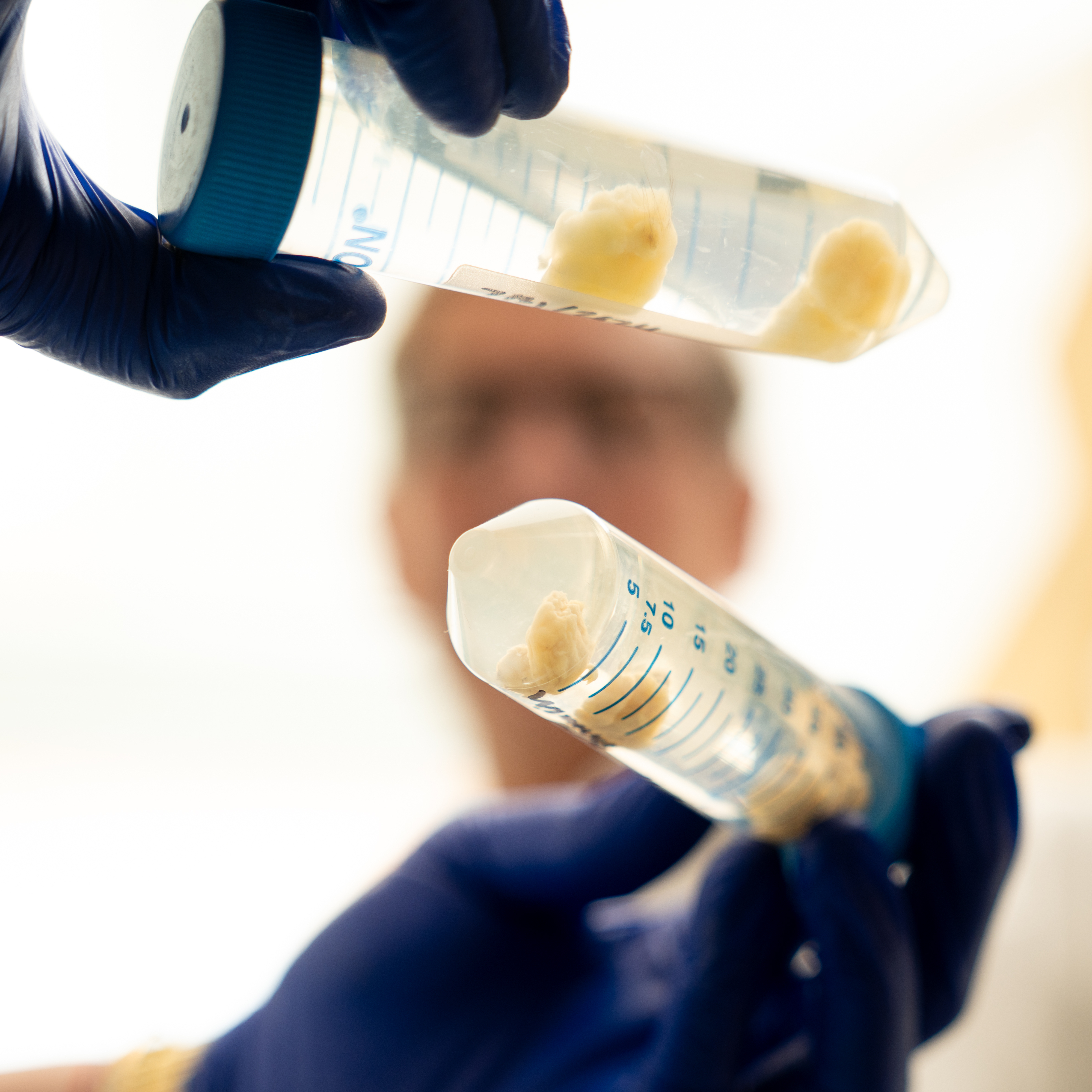 Gloved hands hold two large tubes containing clumps of cells in a clear liquid